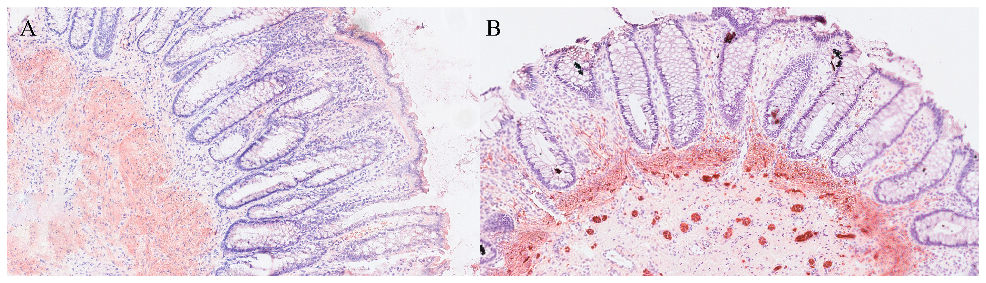 Gastroent 16 00046 g022 Gastroent 16 00046 g022