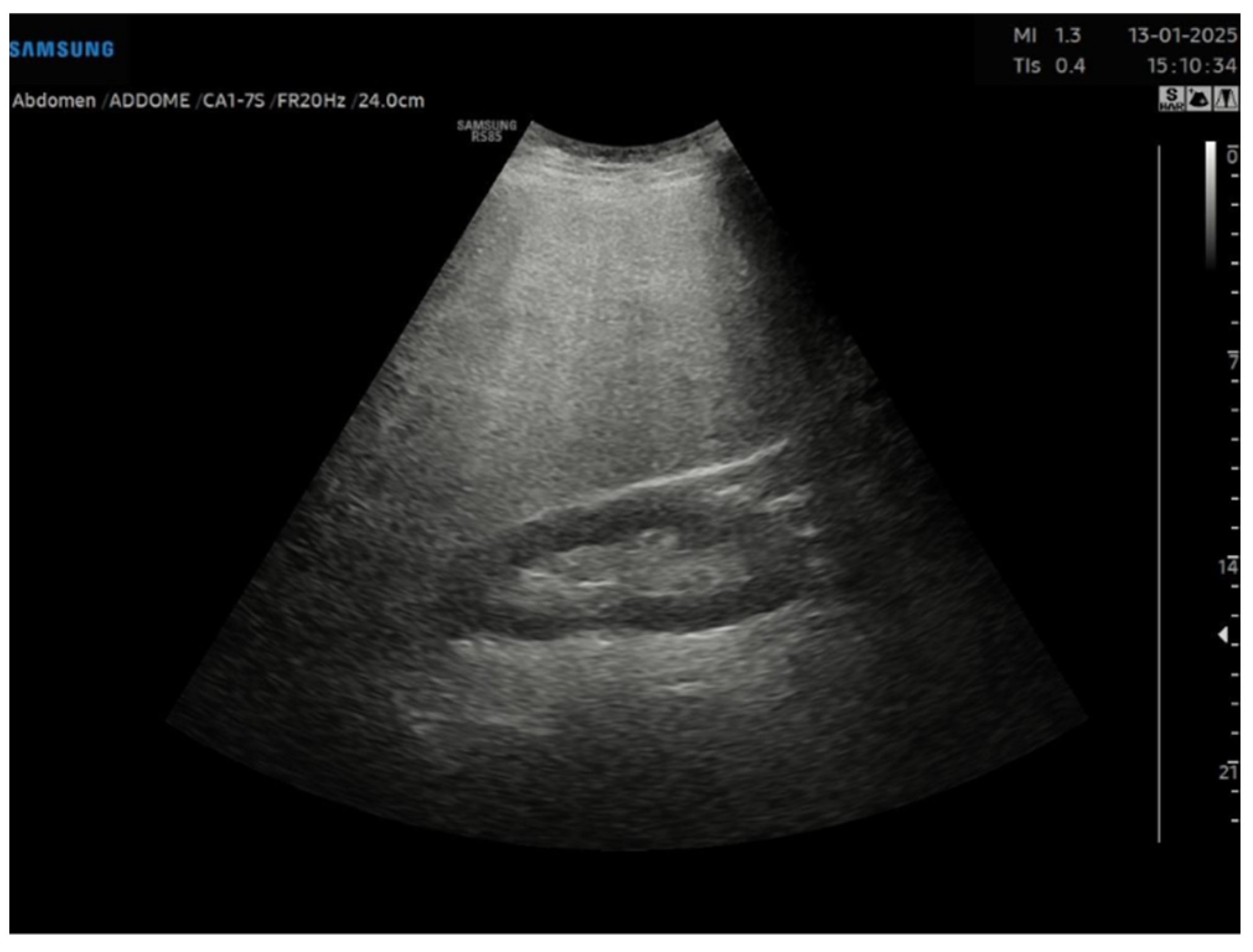 Gastroent 16 00047 g001