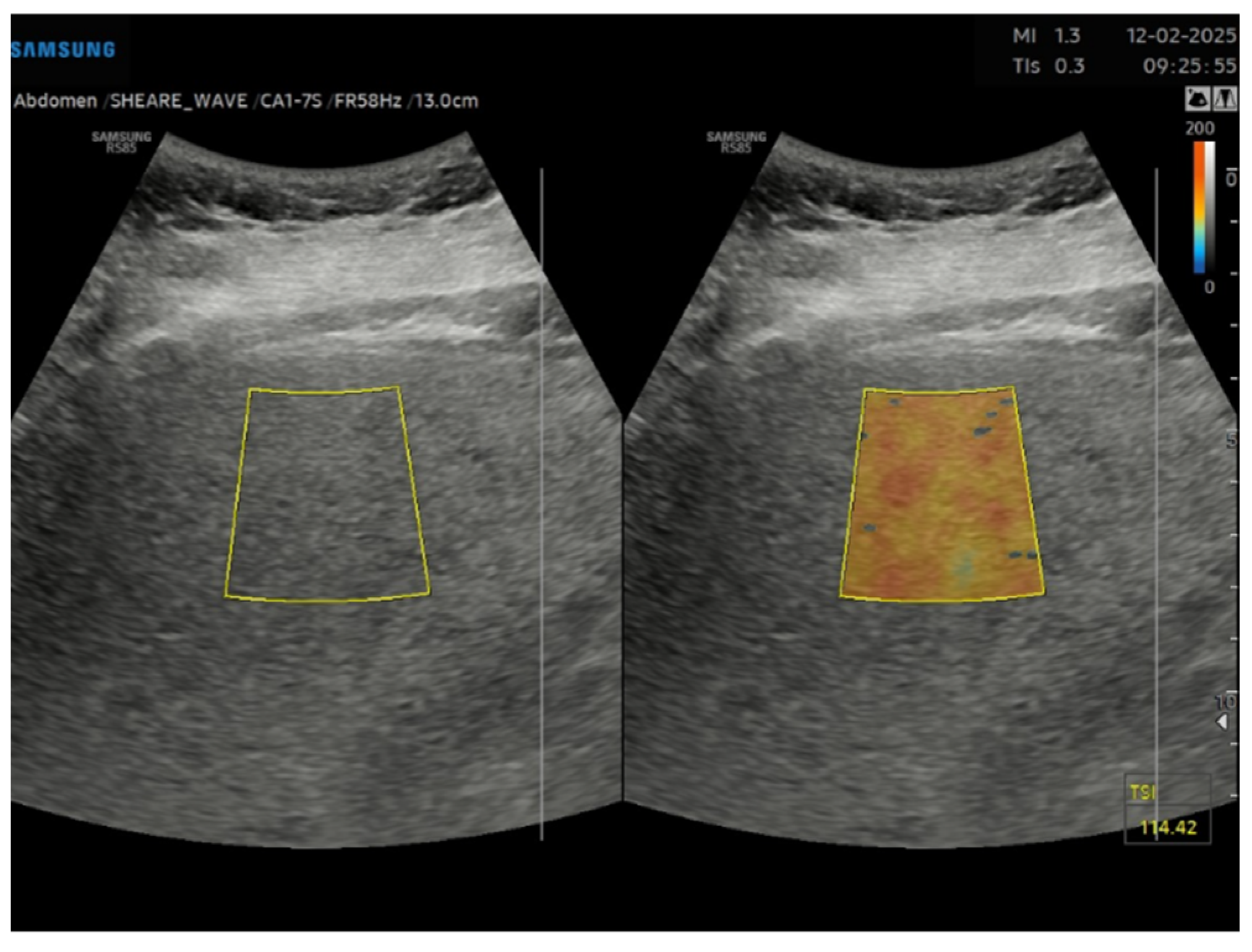 Gastroent 16 00047 g002