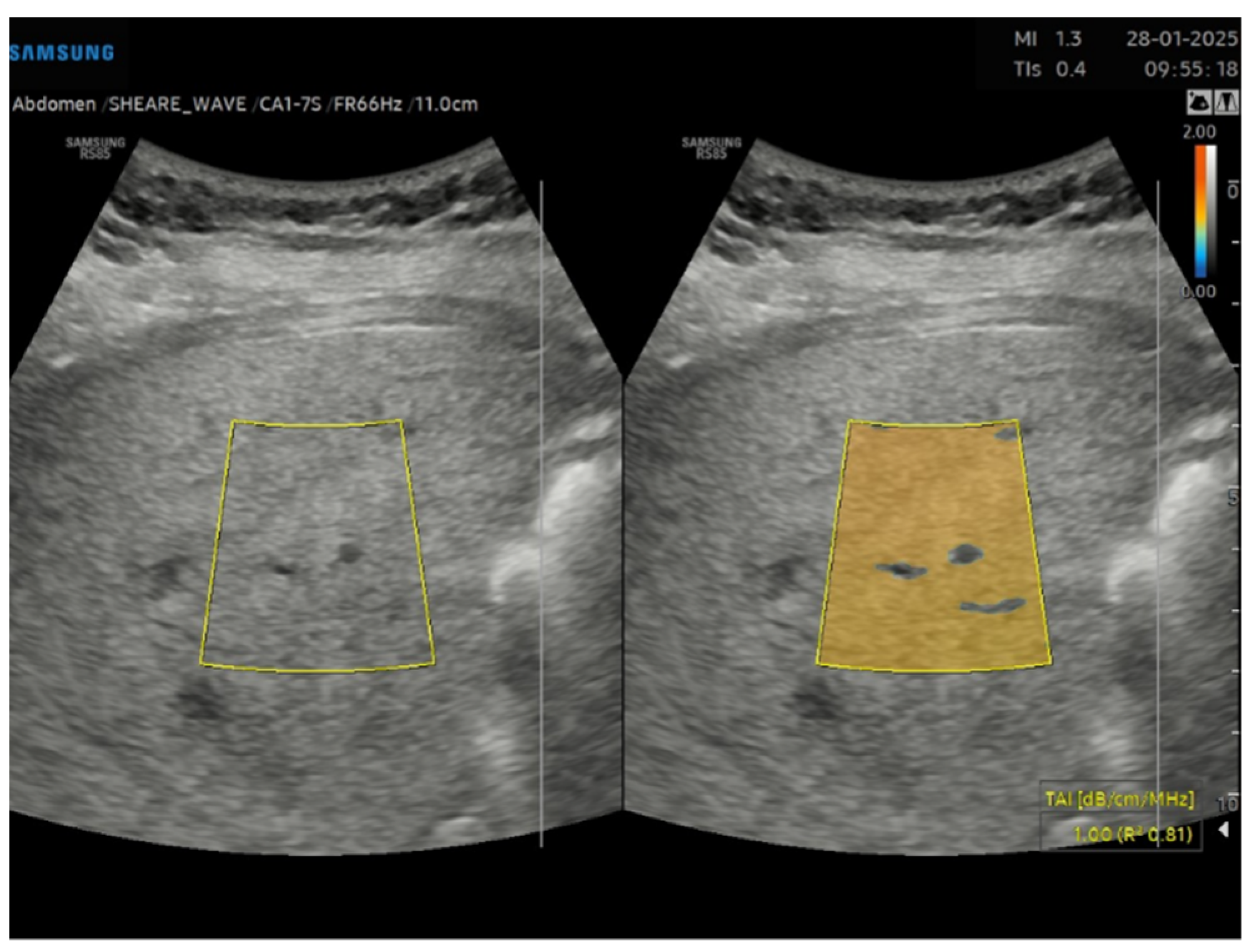 Gastroent 16 00047 g003