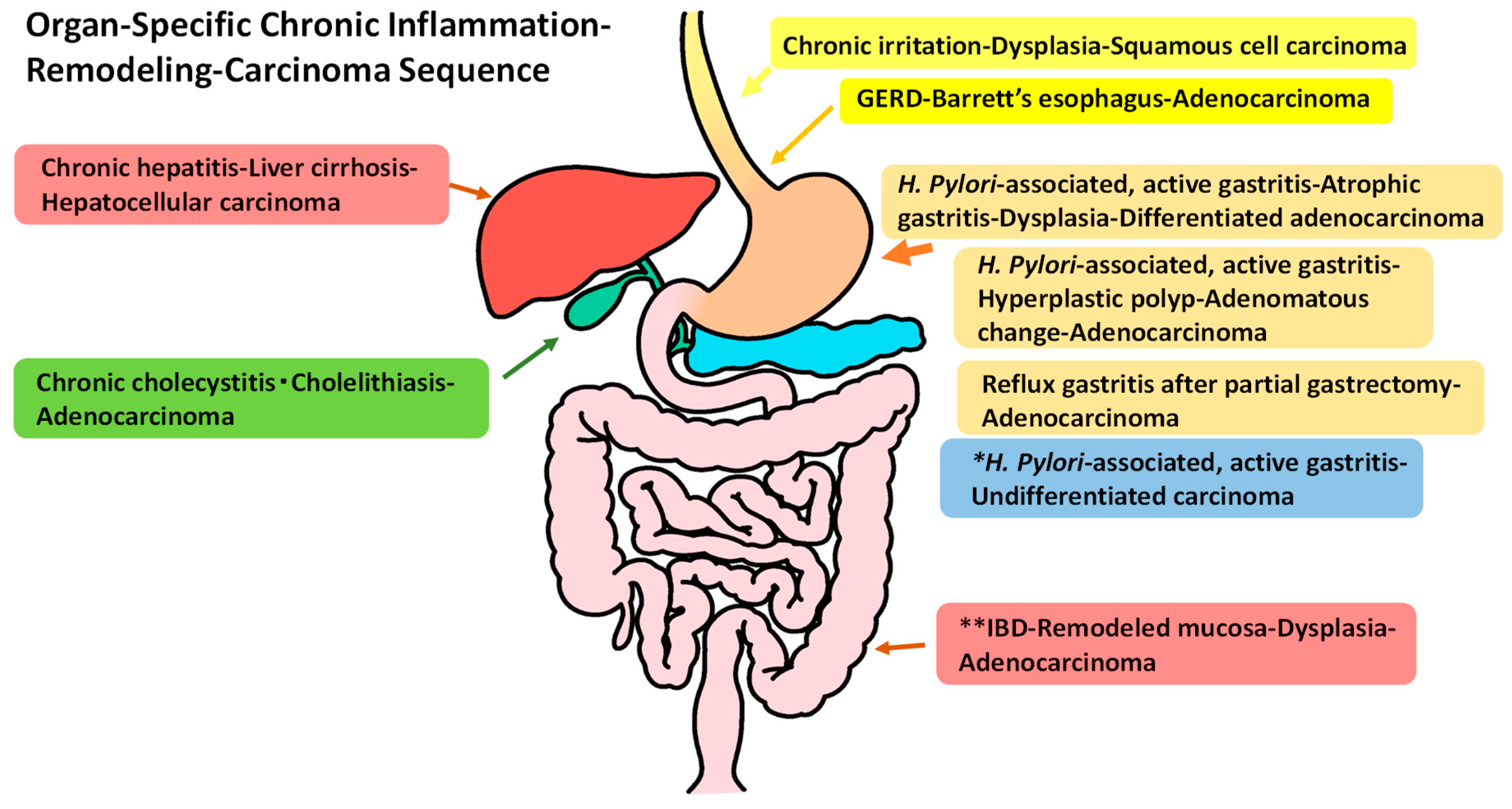 Gastrointestdisord Free Full Text Proposal For An Organ Specific Chronic Inflammation Remodeling Carcinoma Sequence Html