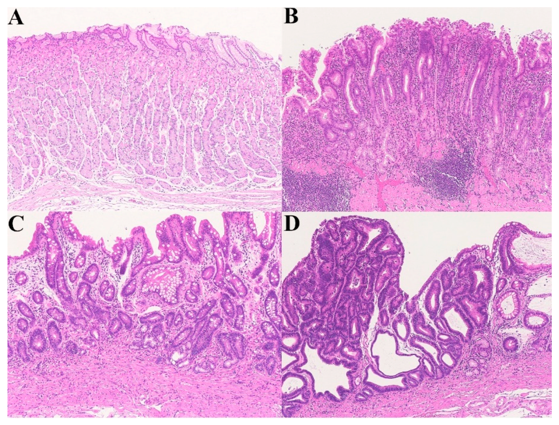 Gastrointestinal Disorders Free FullText Proposal for an Organ