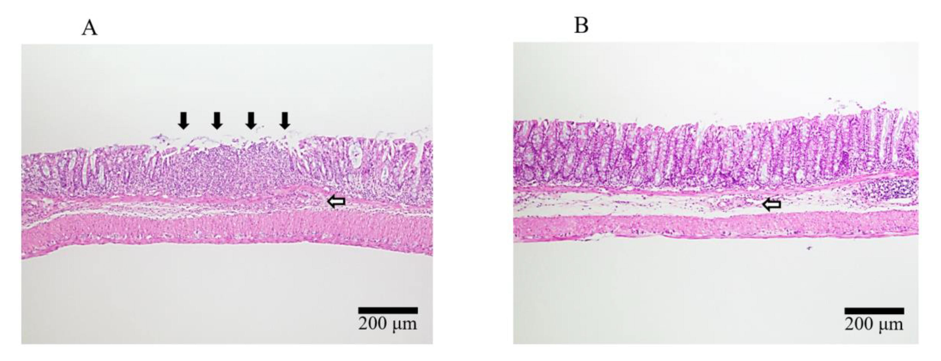 Gastrointestdisord 02 00033 g007 Gastrointestdisord 02 00033 g007