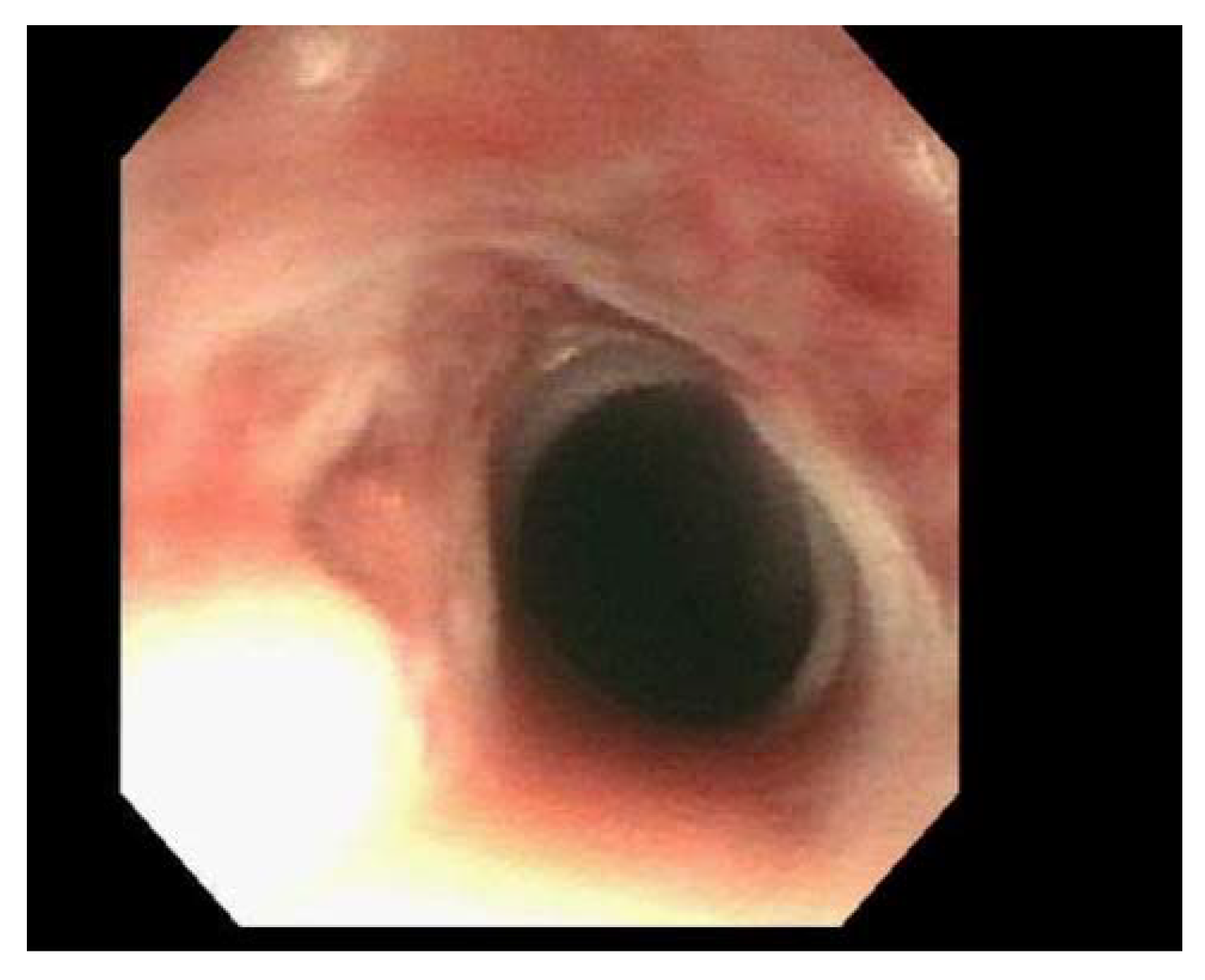 Gastrointestdisord 02 00037 g003