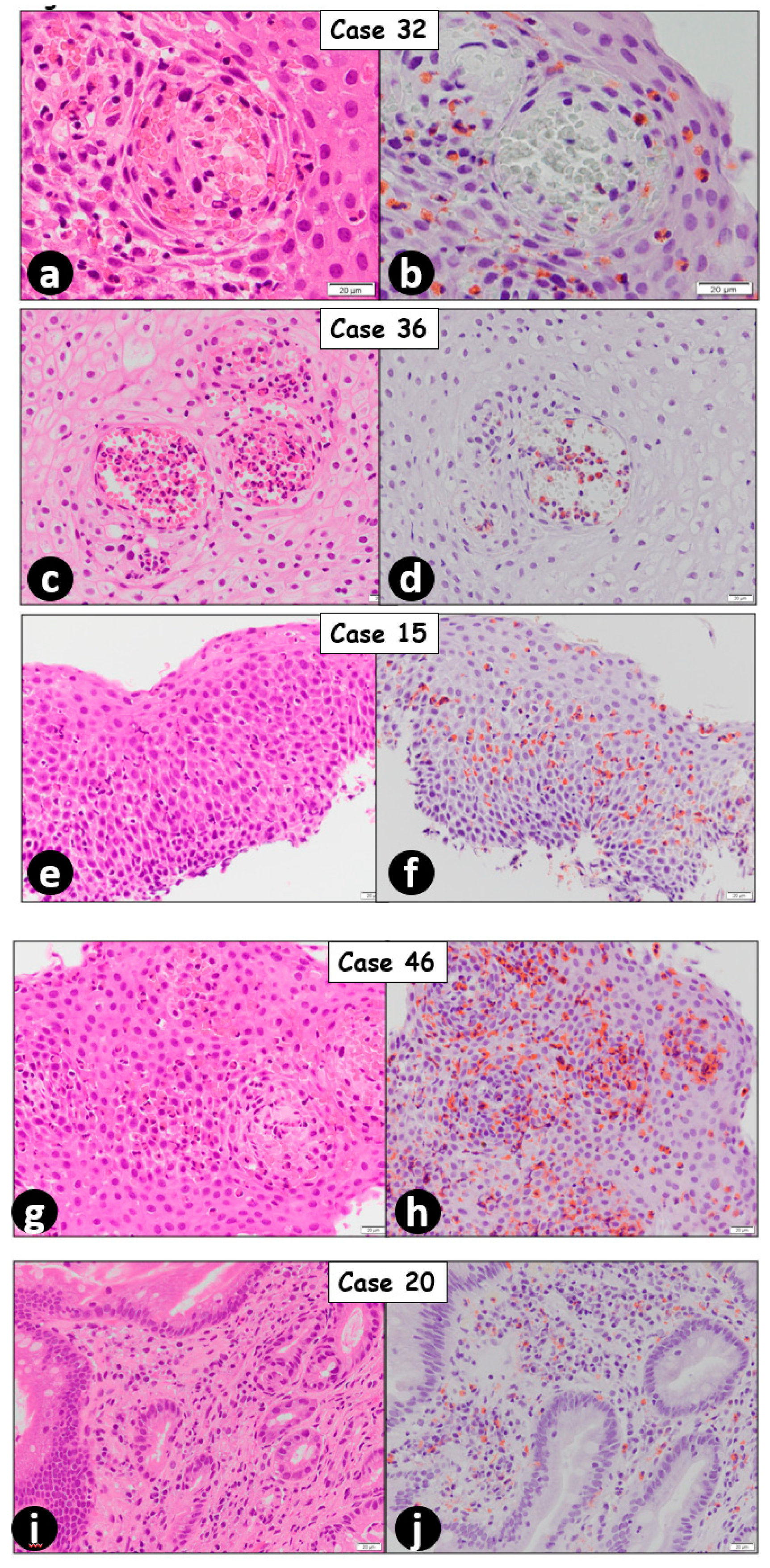 Gastrointestdisord 02 00040 g001 Gastrointestdisord 02 00040 g001