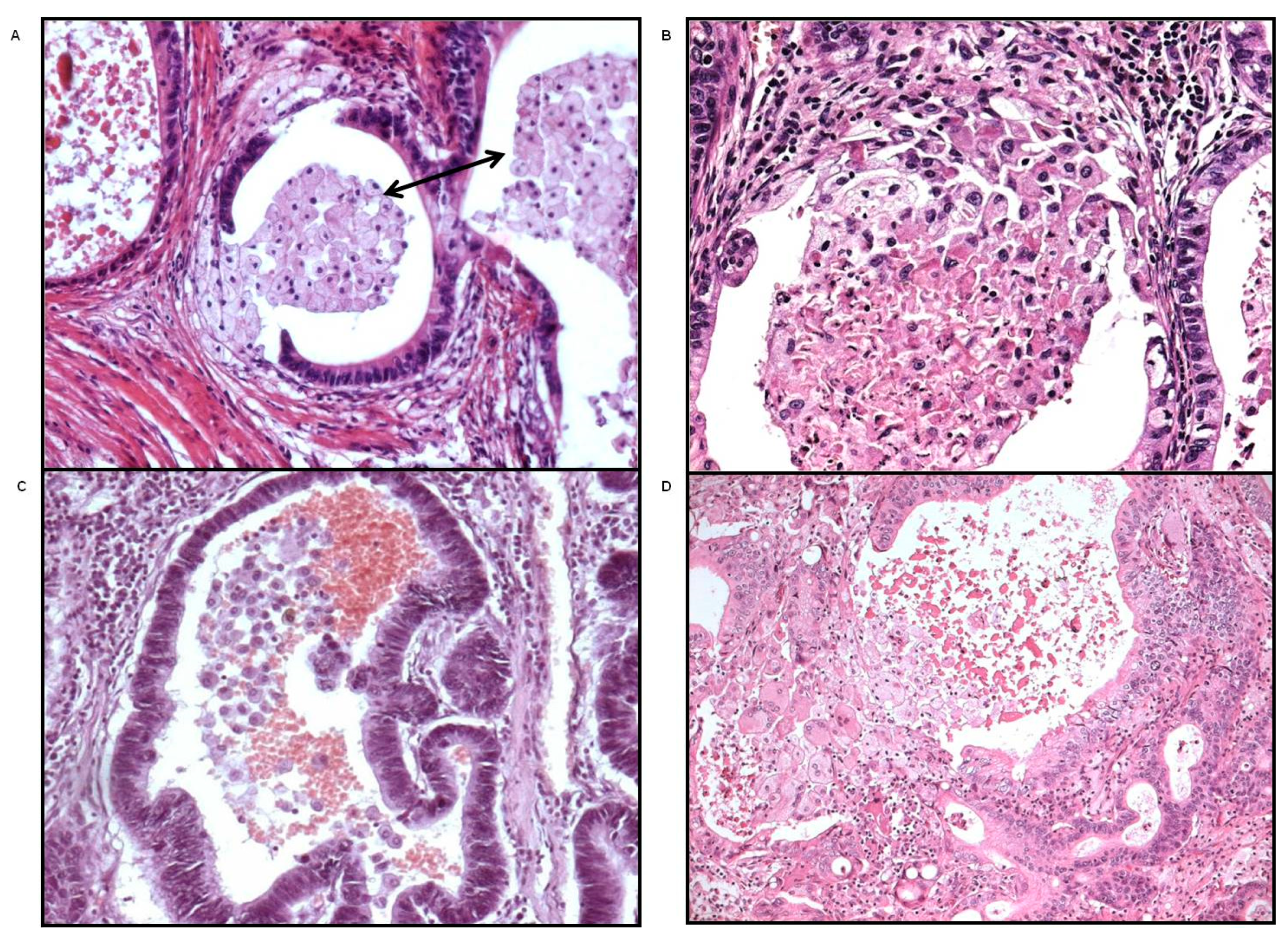 Gastrointestdisord 03 00020 g001