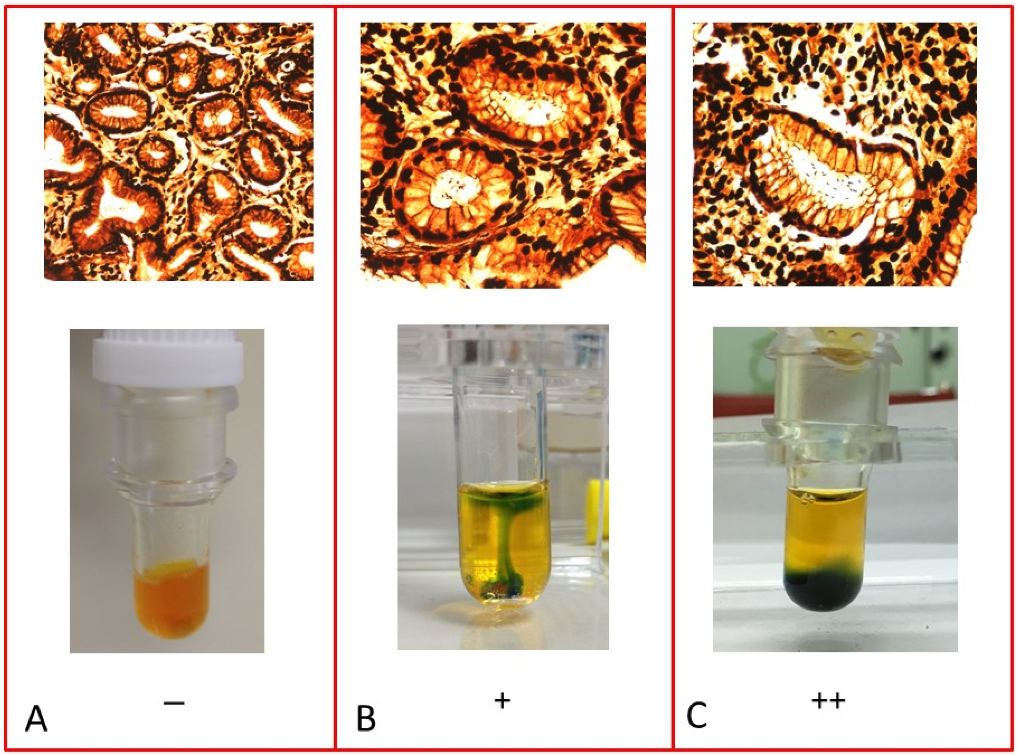 Gastrointestdisord 04 00019 g002 550