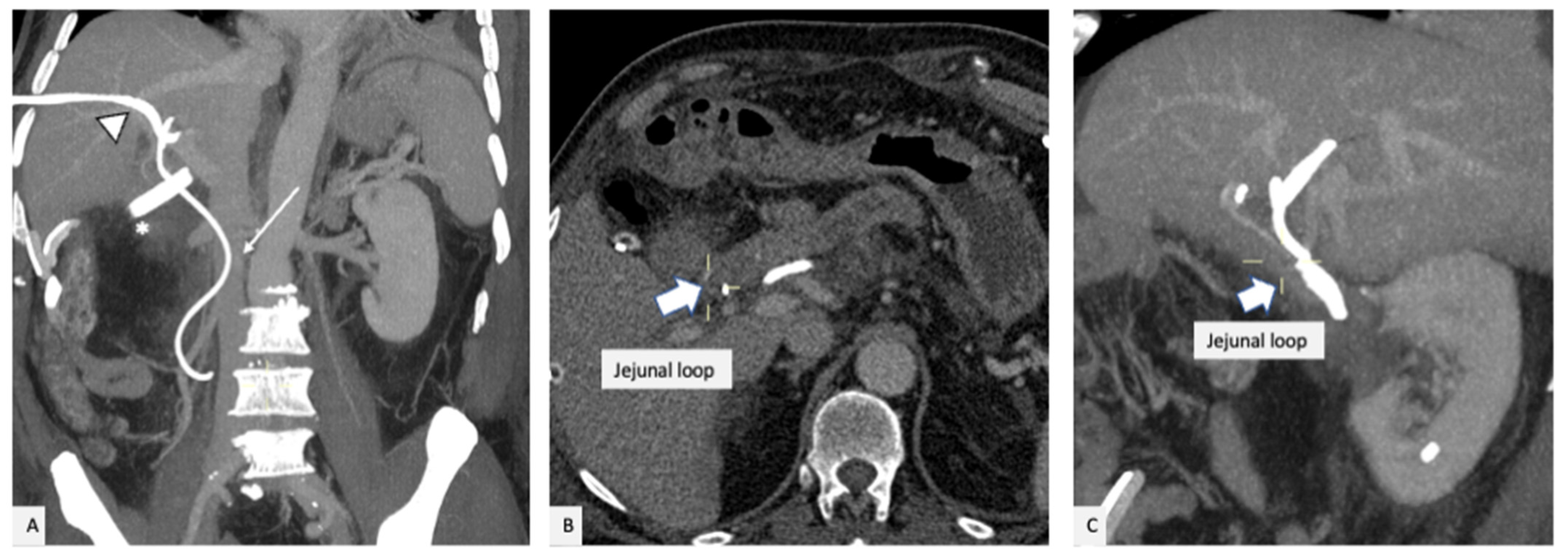 Gastrointestdisord 05 00007 g004
