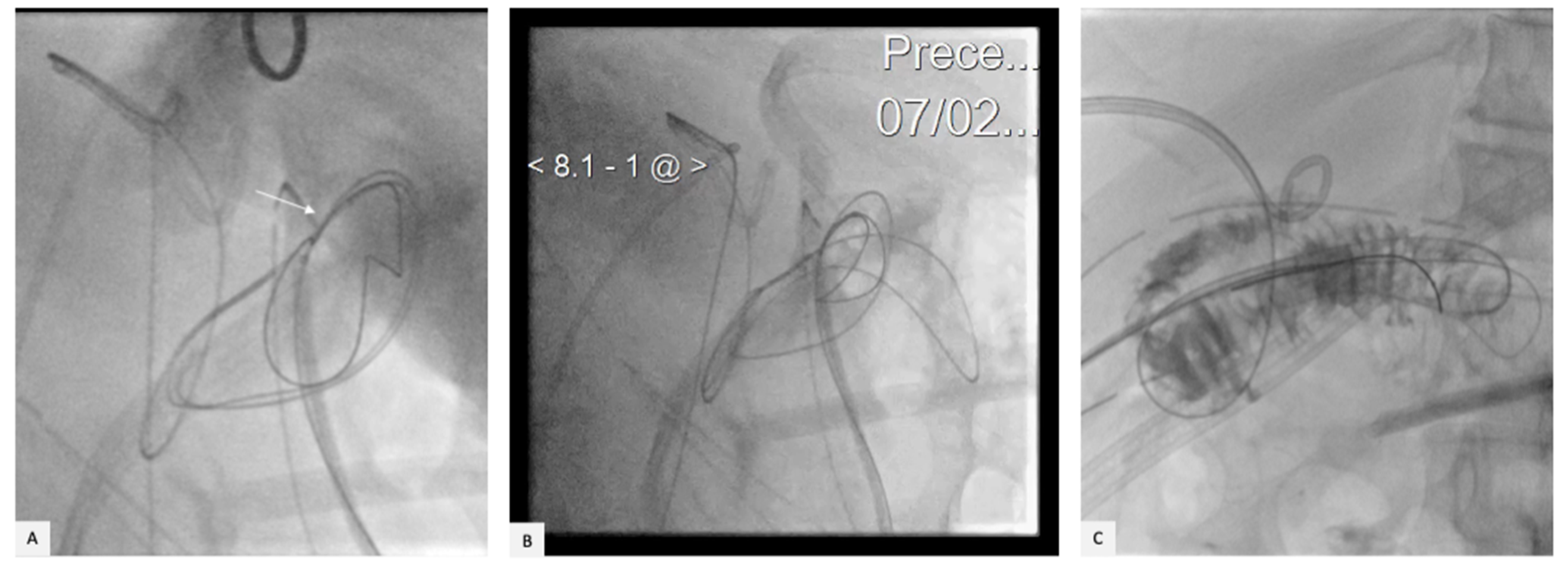 Gastrointestdisord 05 00007 g006