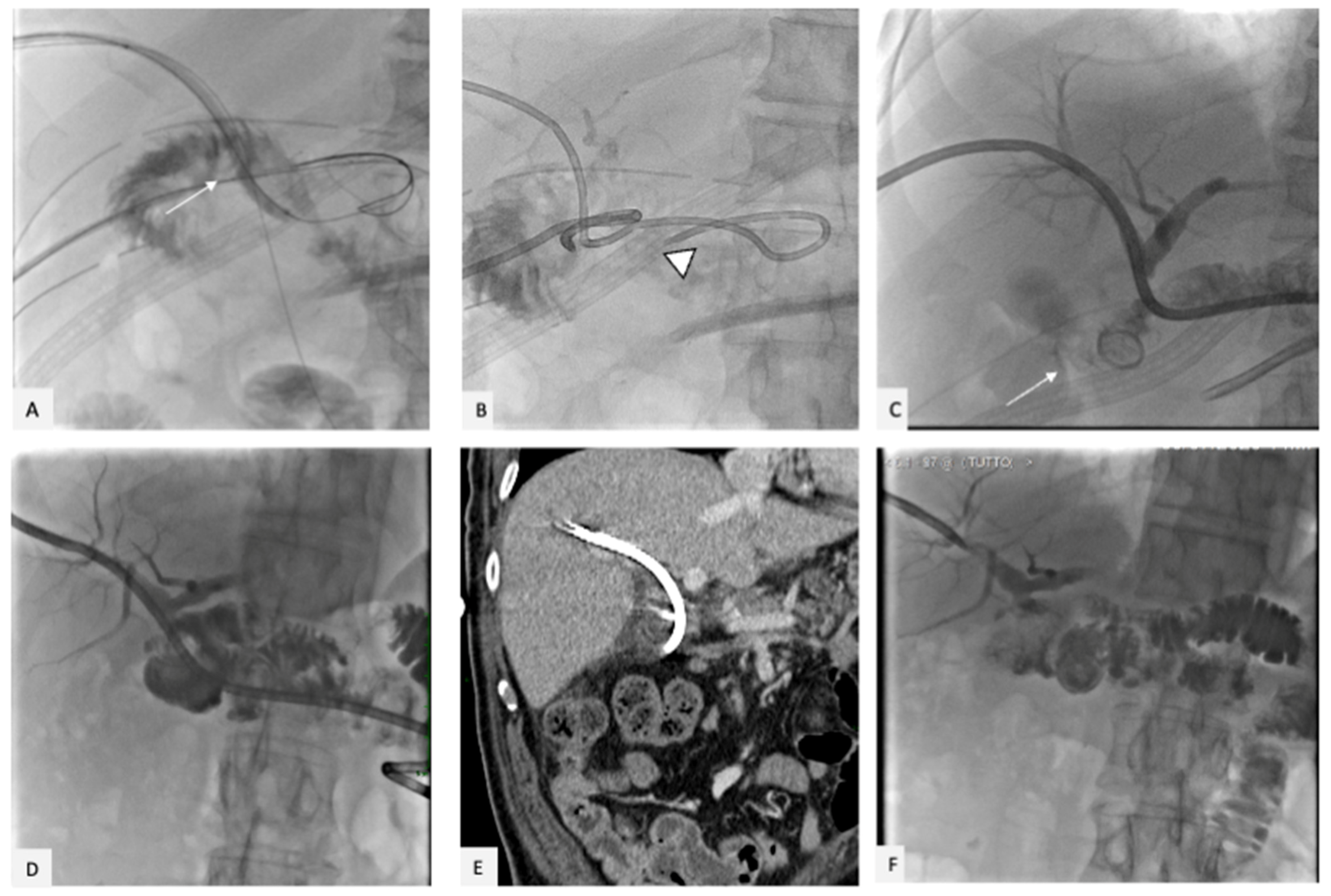 Gastrointestdisord 05 00007 g007