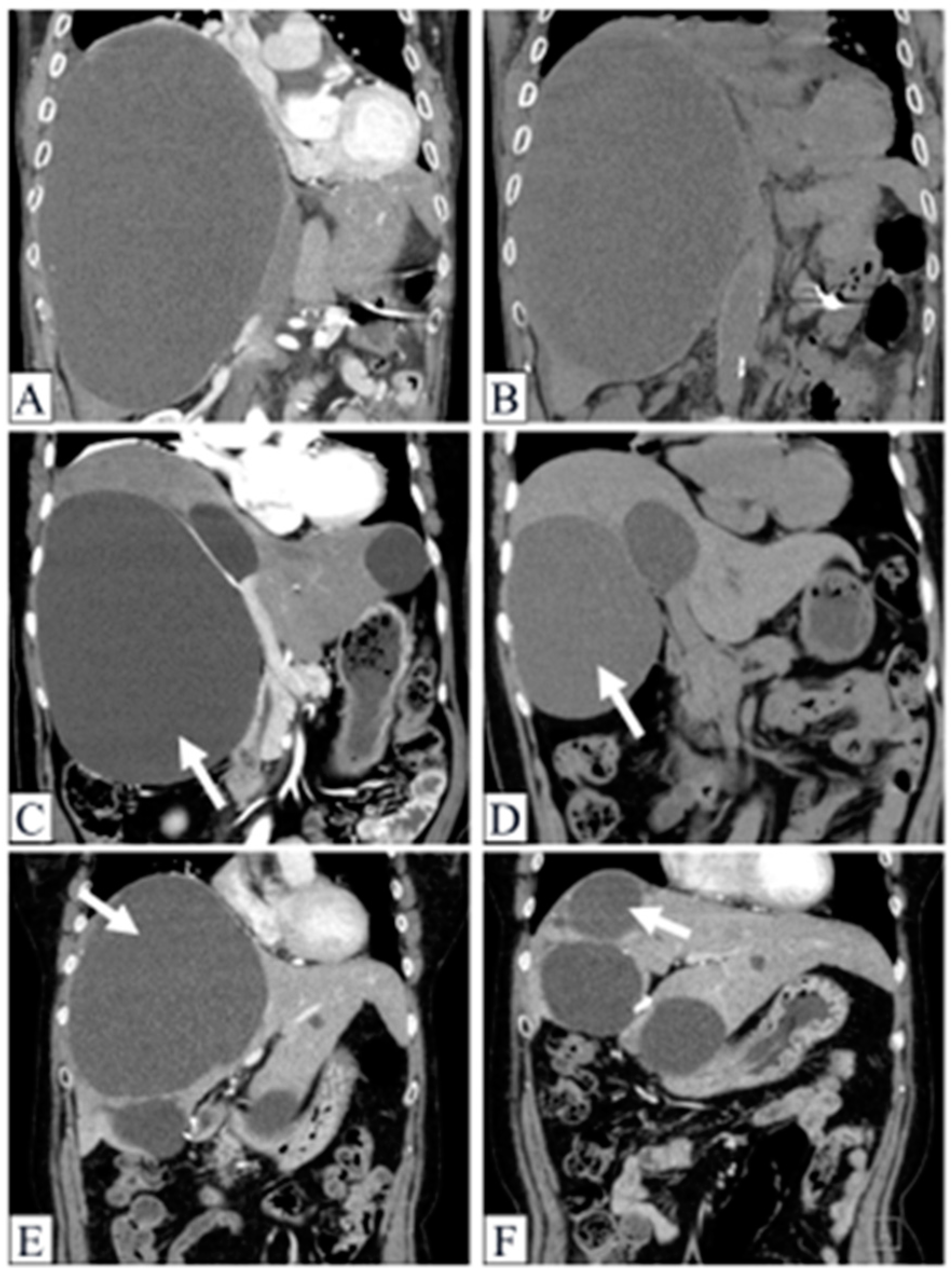 Gastrointestdisord 06 00002 g005