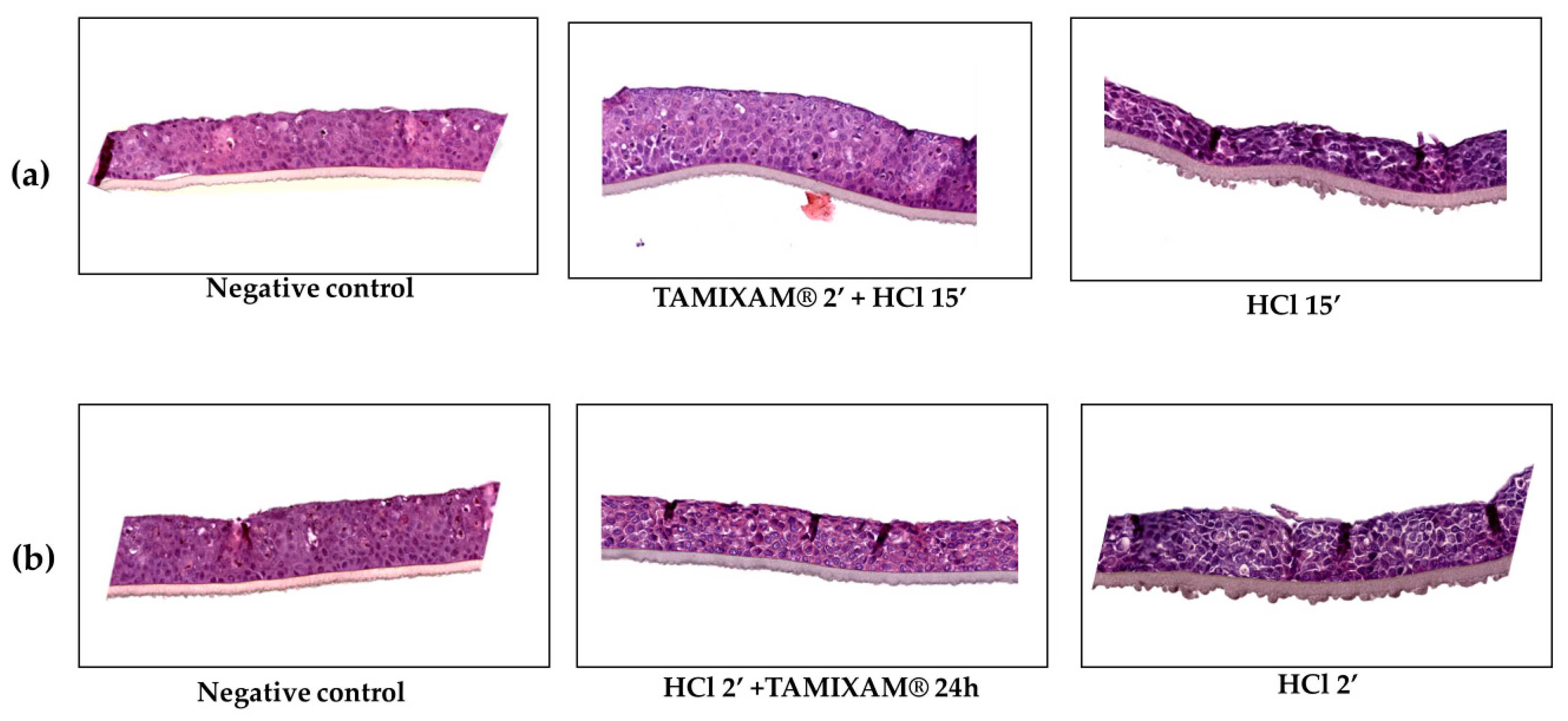 Gastrointestdisord 06 00015 g004 Gastrointestdisord 06 00015 g004