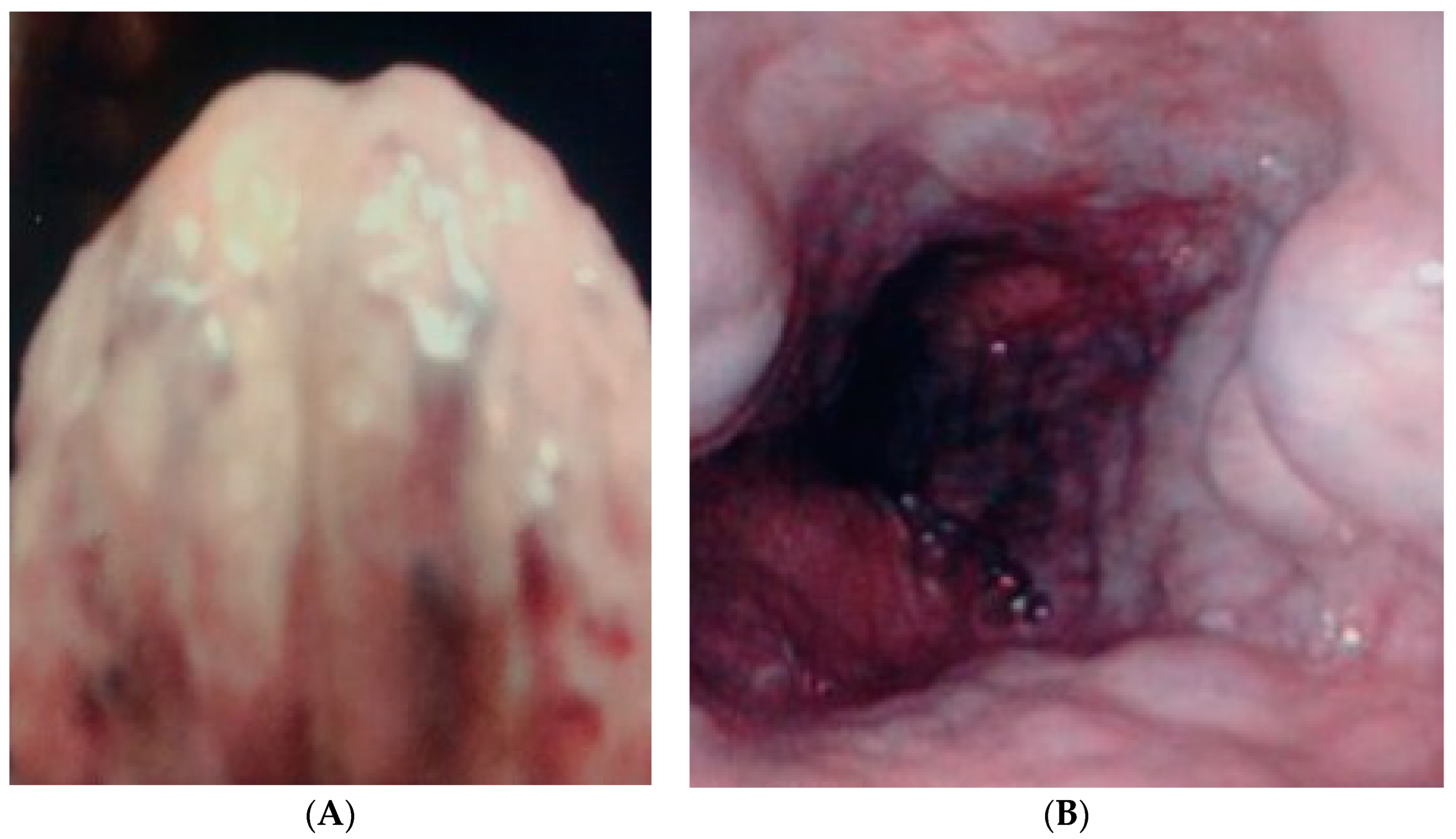 Gastrointestdisord 06 00017 g002 Gastrointestdisord 06 00017 g002