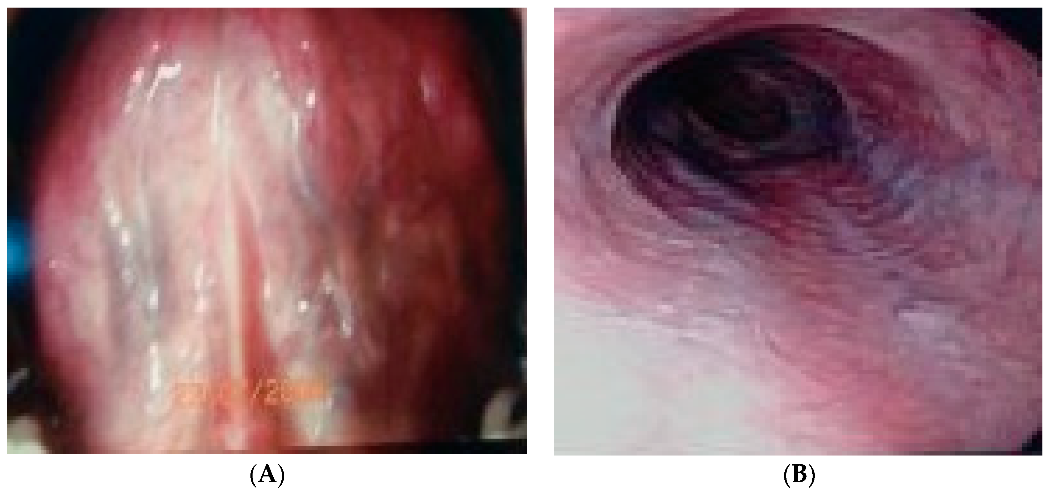 Gastrointestdisord 06 00017 g003 Gastrointestdisord 06 00017 g003