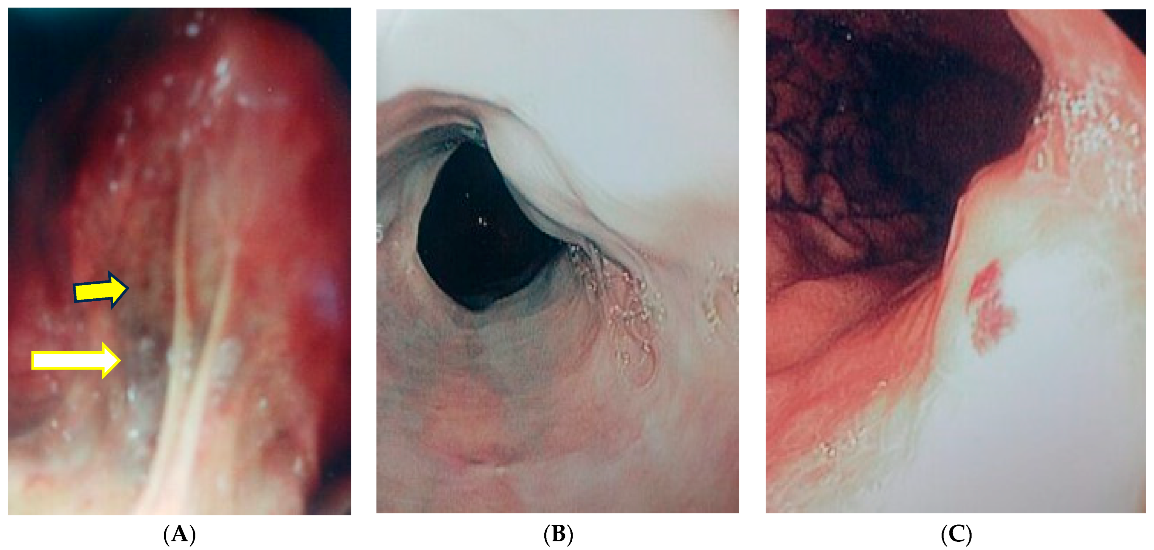 Gastrointestdisord 06 00017 g004 Gastrointestdisord 06 00017 g004