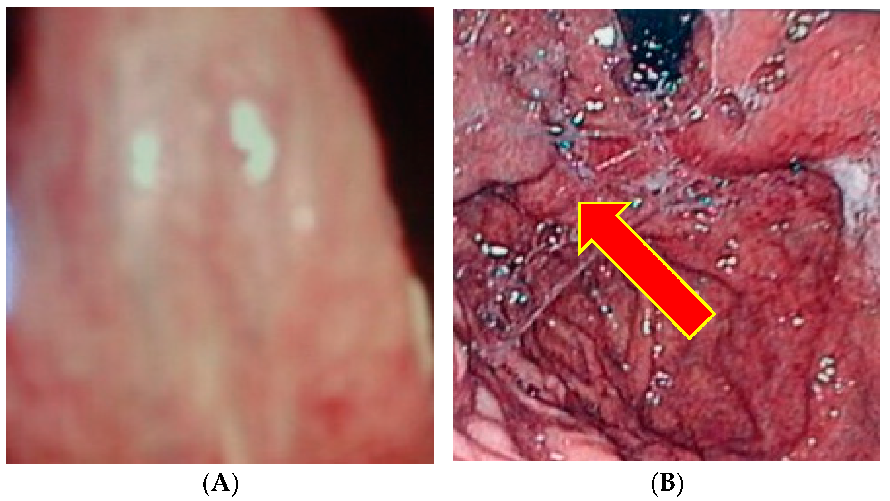 Gastrointestdisord 06 00017 g005 Gastrointestdisord 06 00017 g005