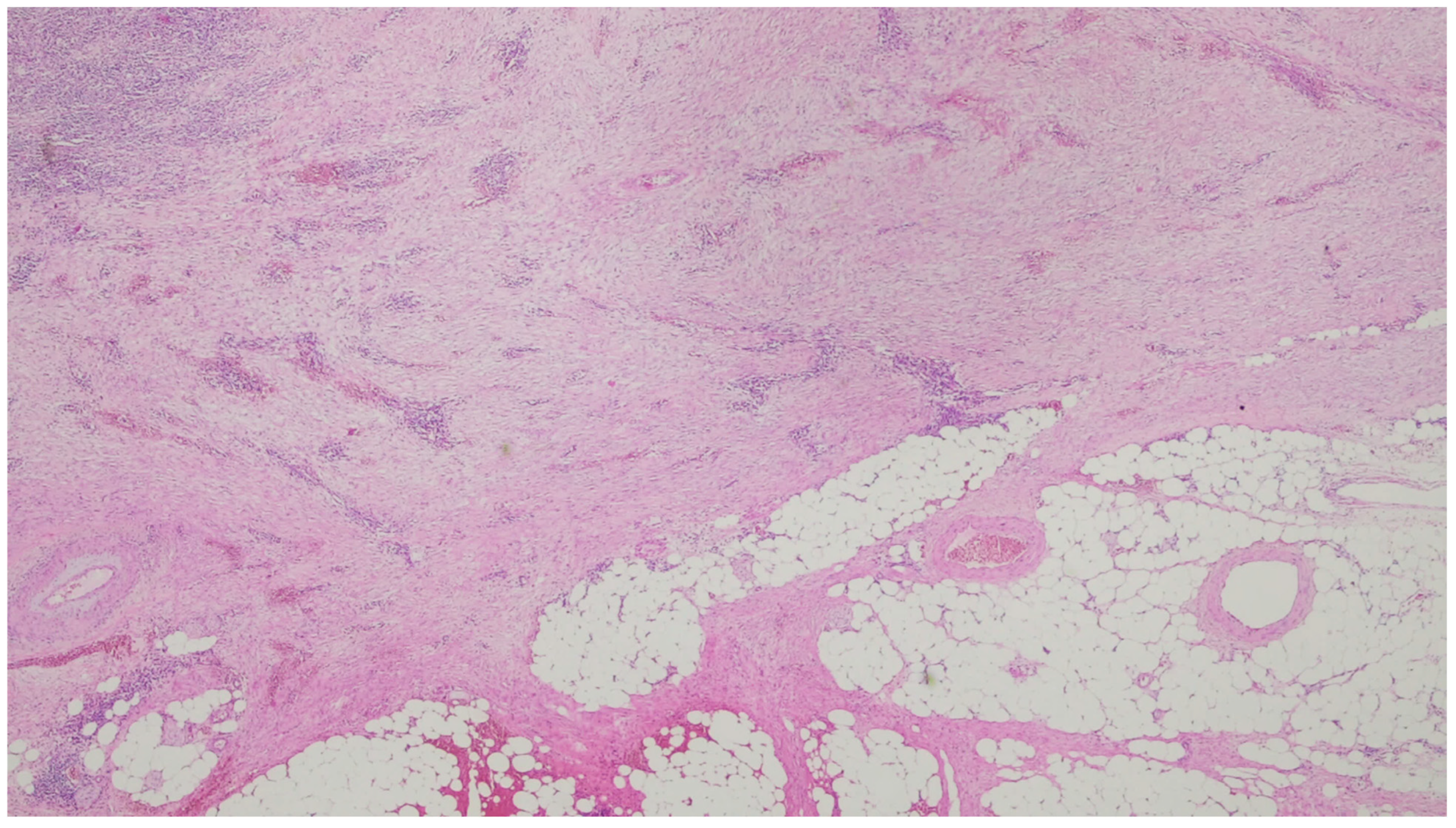 Gastrointestdisord 06 00019 g003 Gastrointestdisord 06 00019 g003