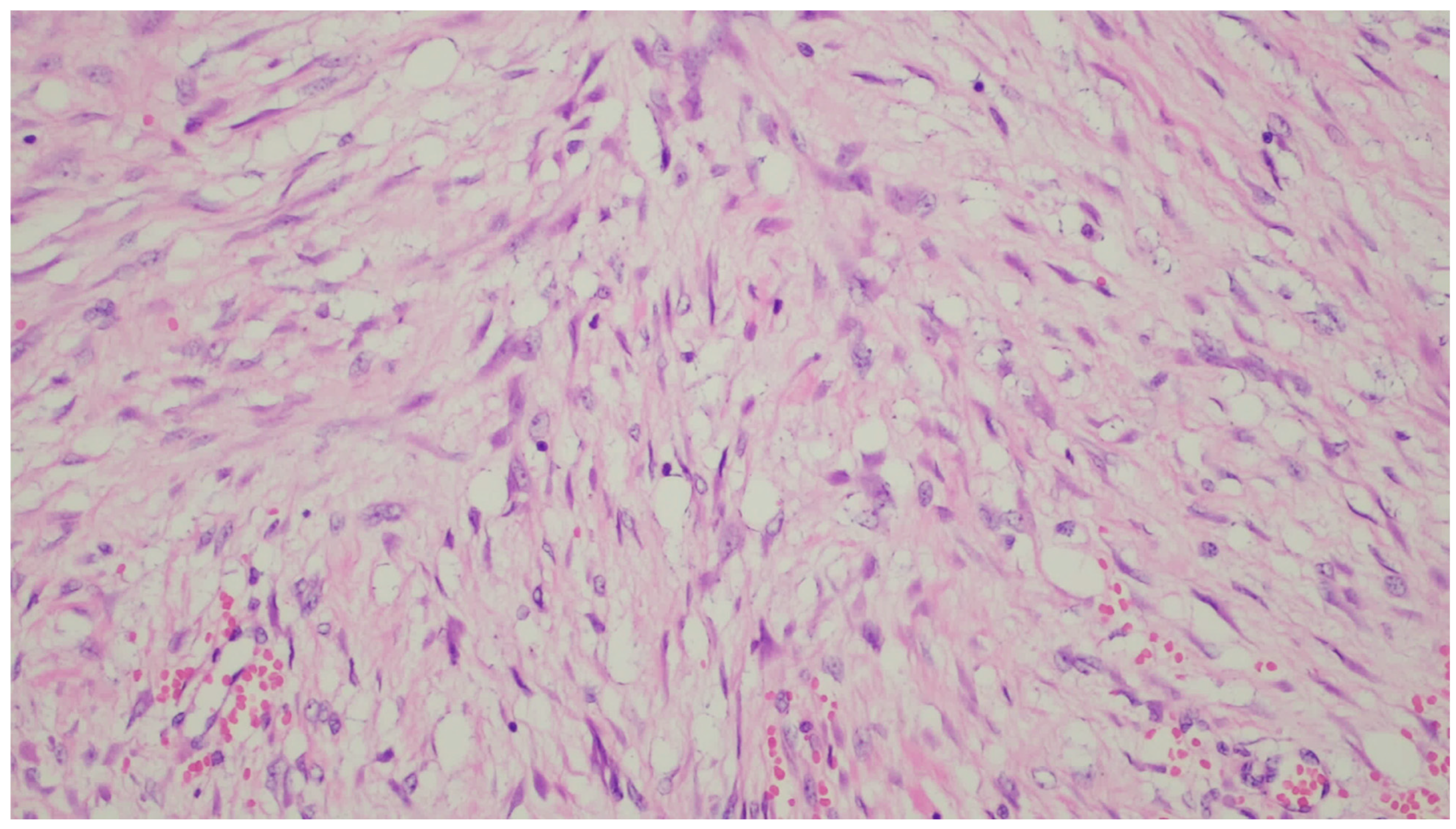 Gastrointestdisord 06 00019 g004 Gastrointestdisord 06 00019 g004