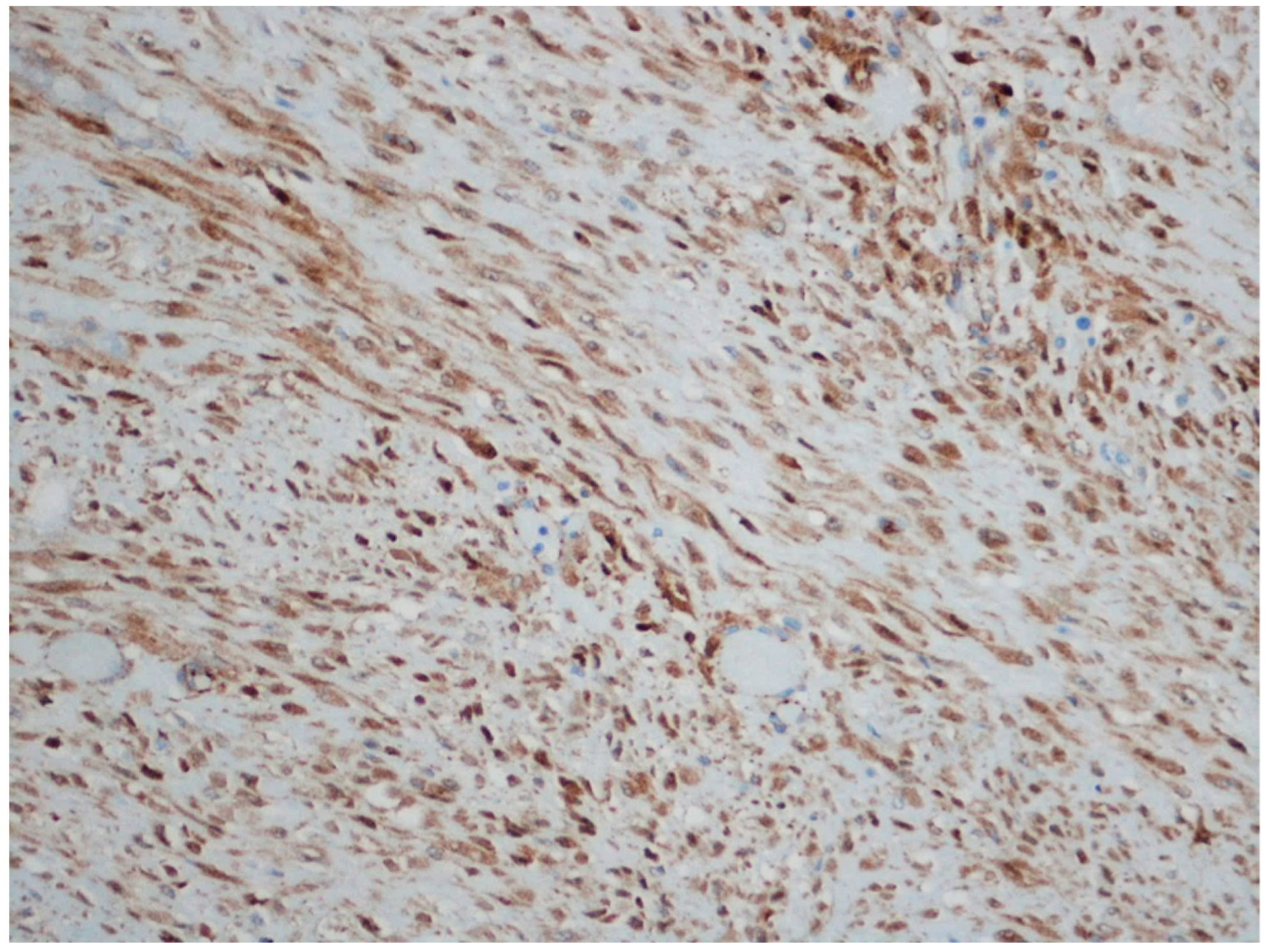 Gastrointestdisord 06 00019 g005 Gastrointestdisord 06 00019 g005