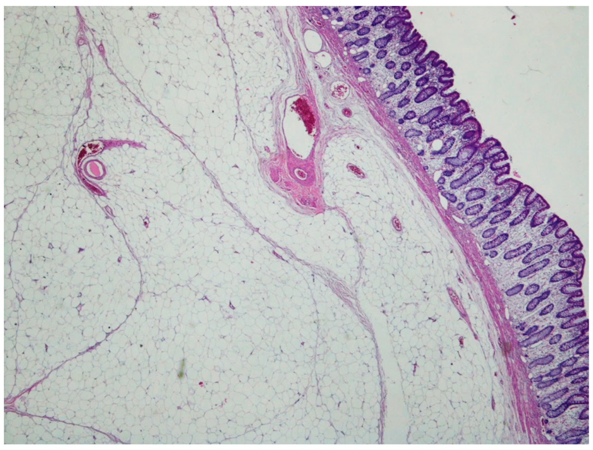 Gastrointestdisord 06 00019 g008 Gastrointestdisord 06 00019 g008