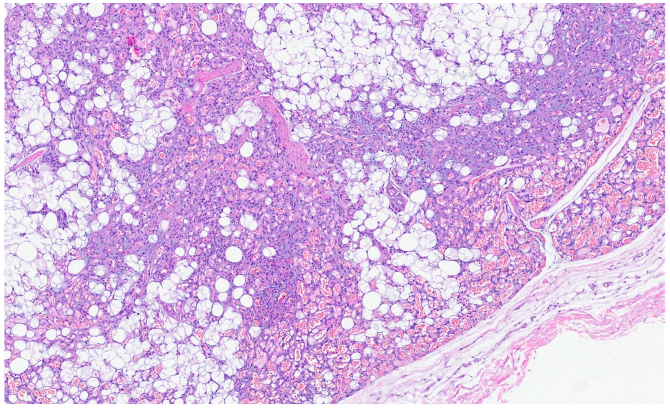 Gastrointestdisord 06 00019 g009 Gastrointestdisord 06 00019 g009