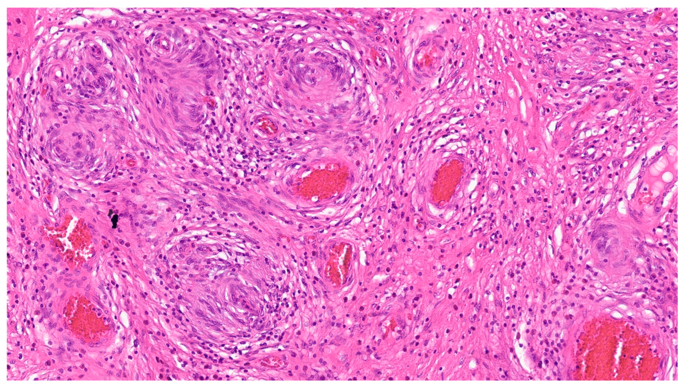 Gastrointestdisord 06 00019 g011 Gastrointestdisord 06 00019 g011