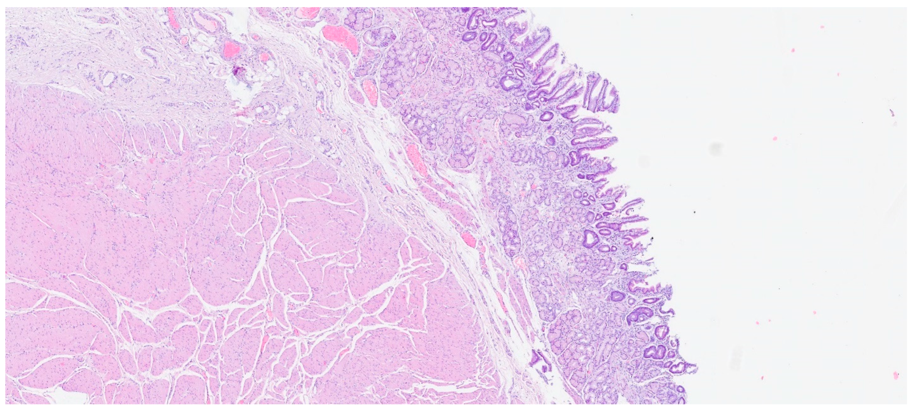 Gastrointestdisord 06 00019 g012 Gastrointestdisord 06 00019 g012