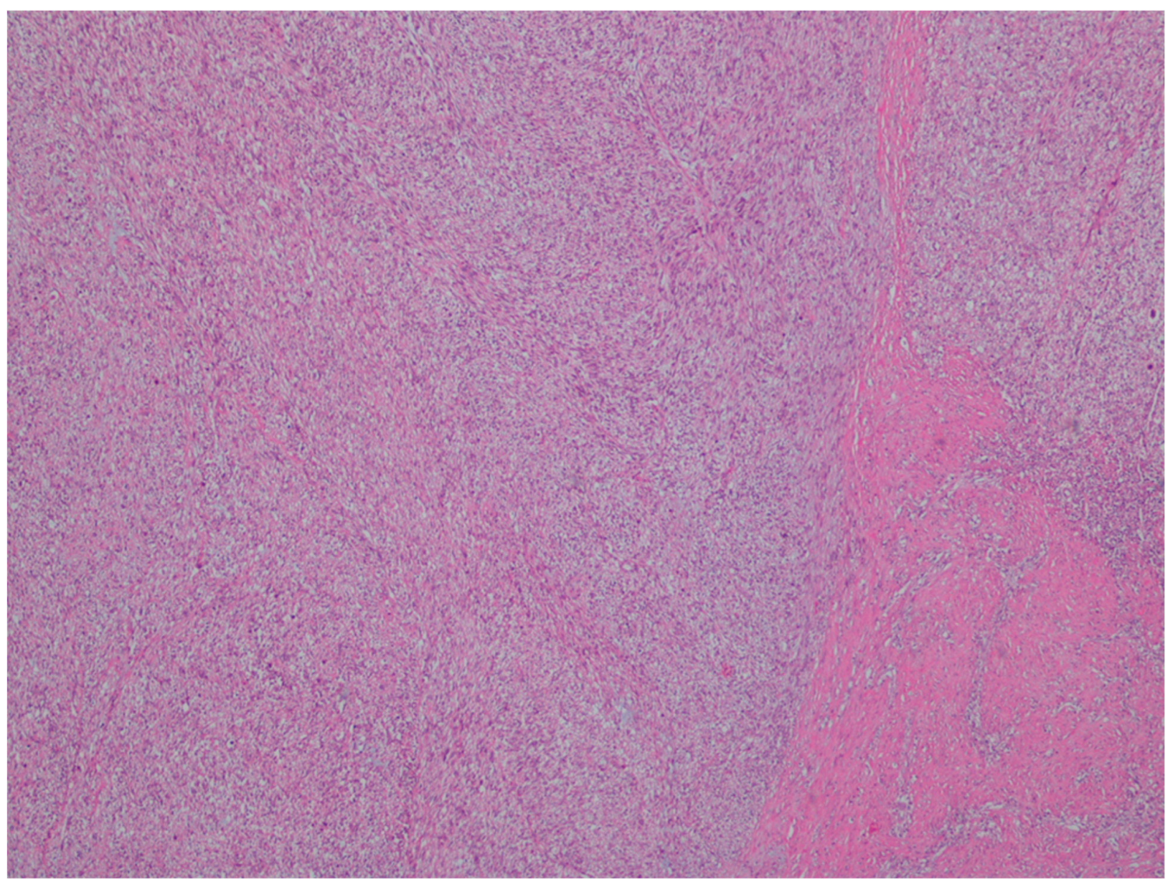 Gastrointestdisord 06 00019 g014 Gastrointestdisord 06 00019 g014