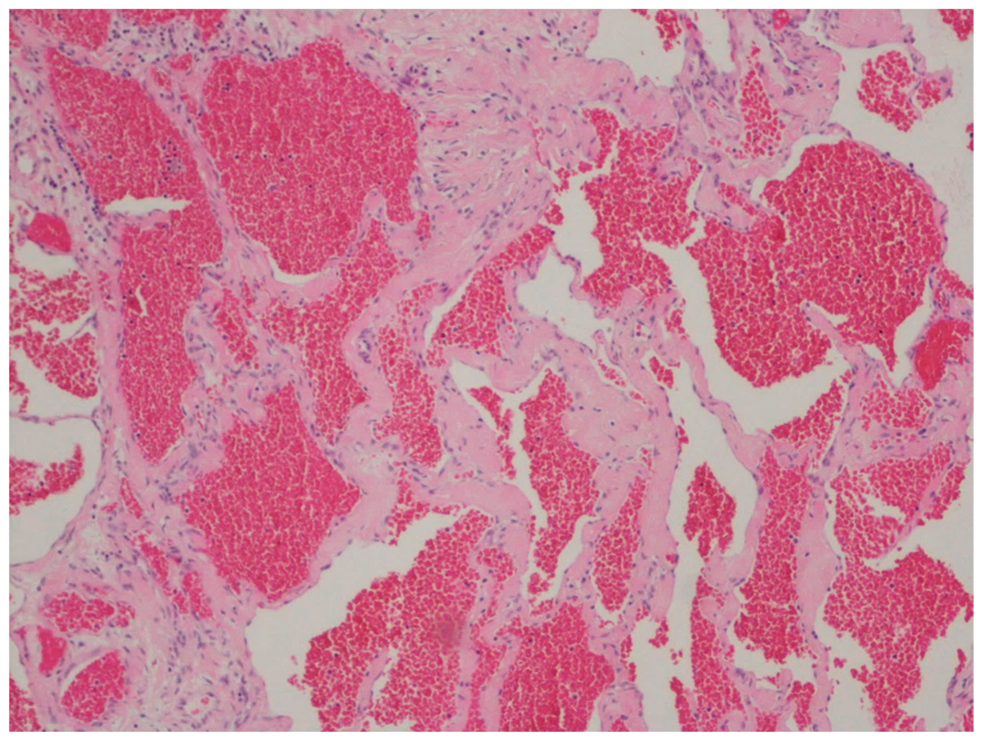 Gastrointestdisord 06 00019 g015 Gastrointestdisord 06 00019 g015