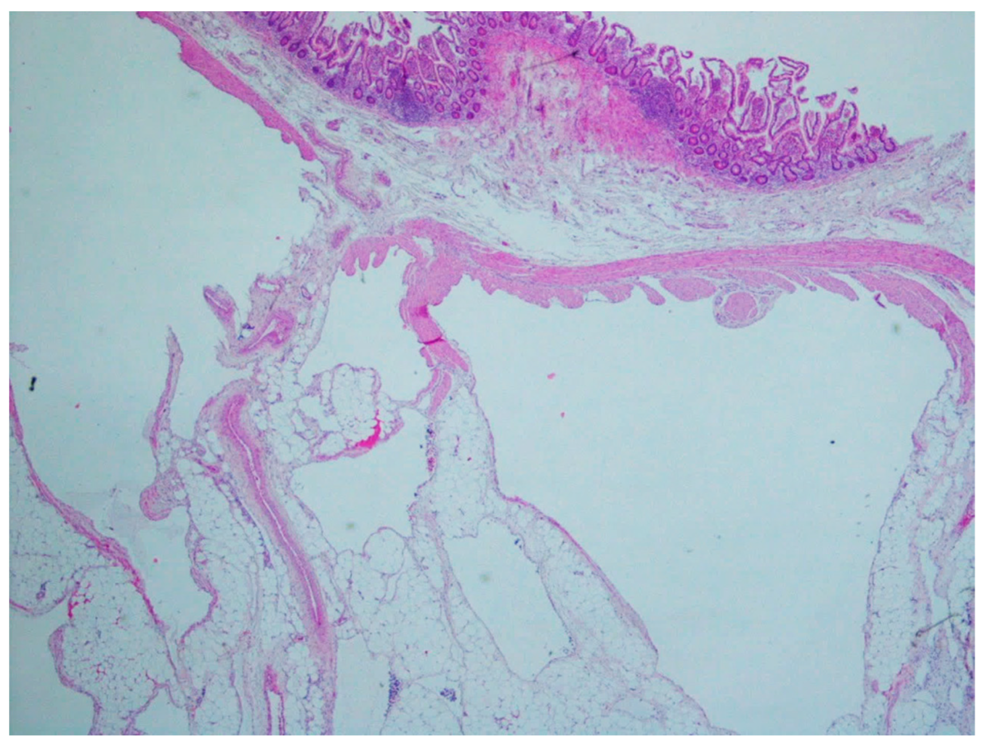 Gastrointestdisord 06 00019 g016 Gastrointestdisord 06 00019 g016