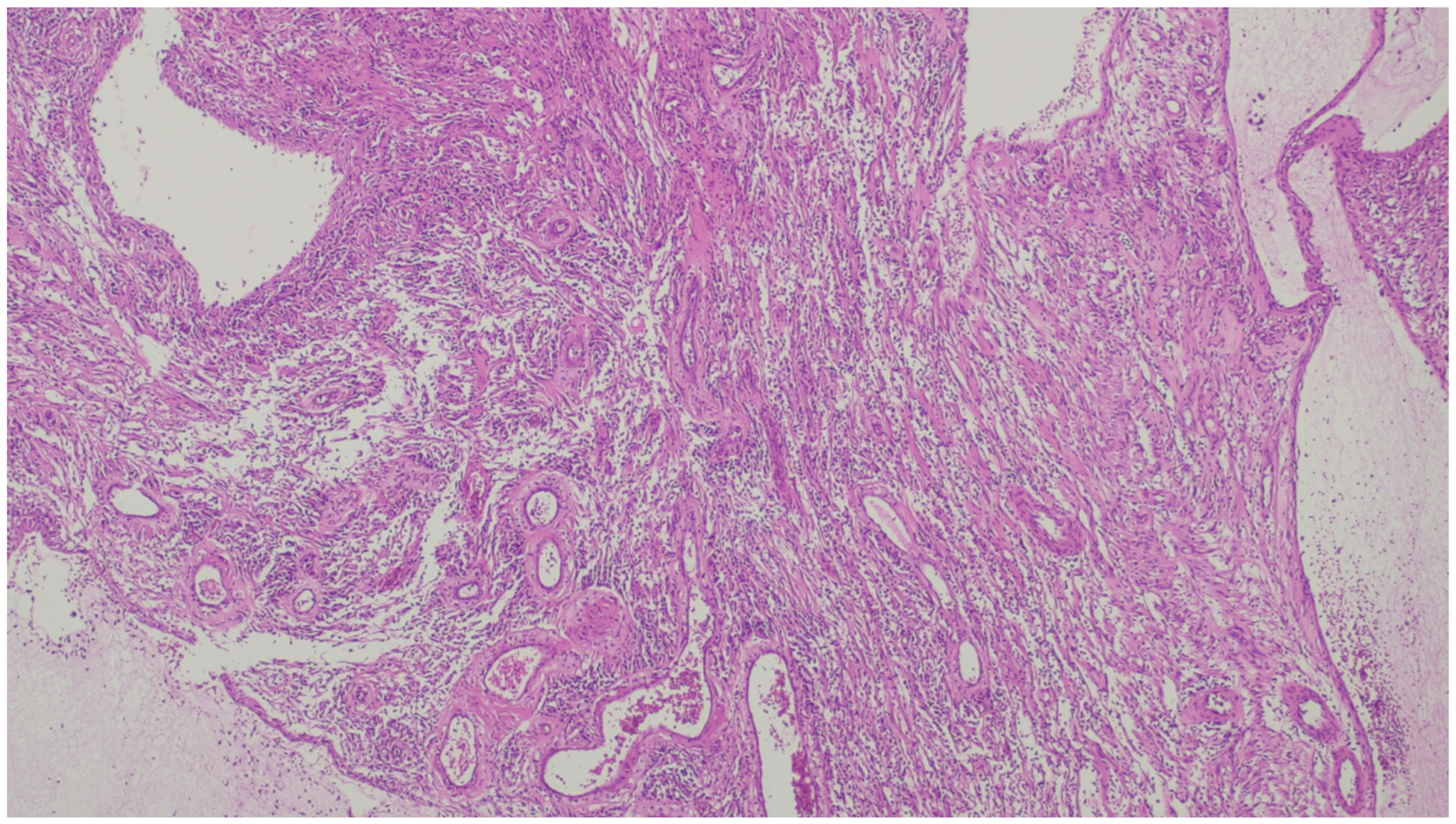 Gastrointestdisord 06 00019 g018 Gastrointestdisord 06 00019 g018