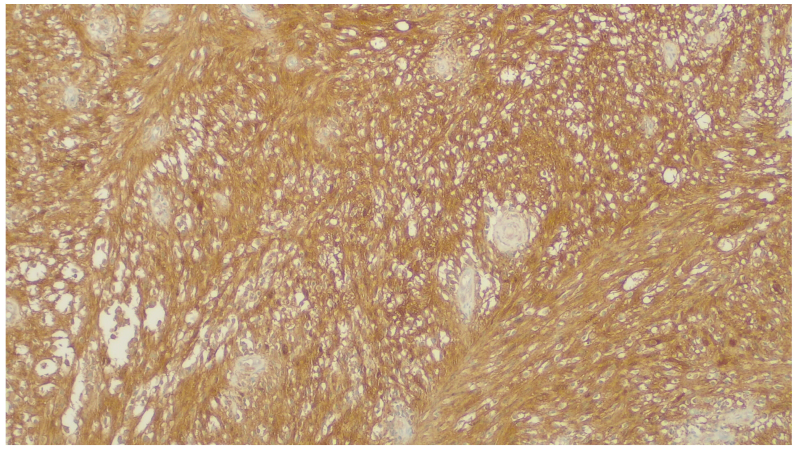 Gastrointestdisord 06 00019 g019 Gastrointestdisord 06 00019 g019