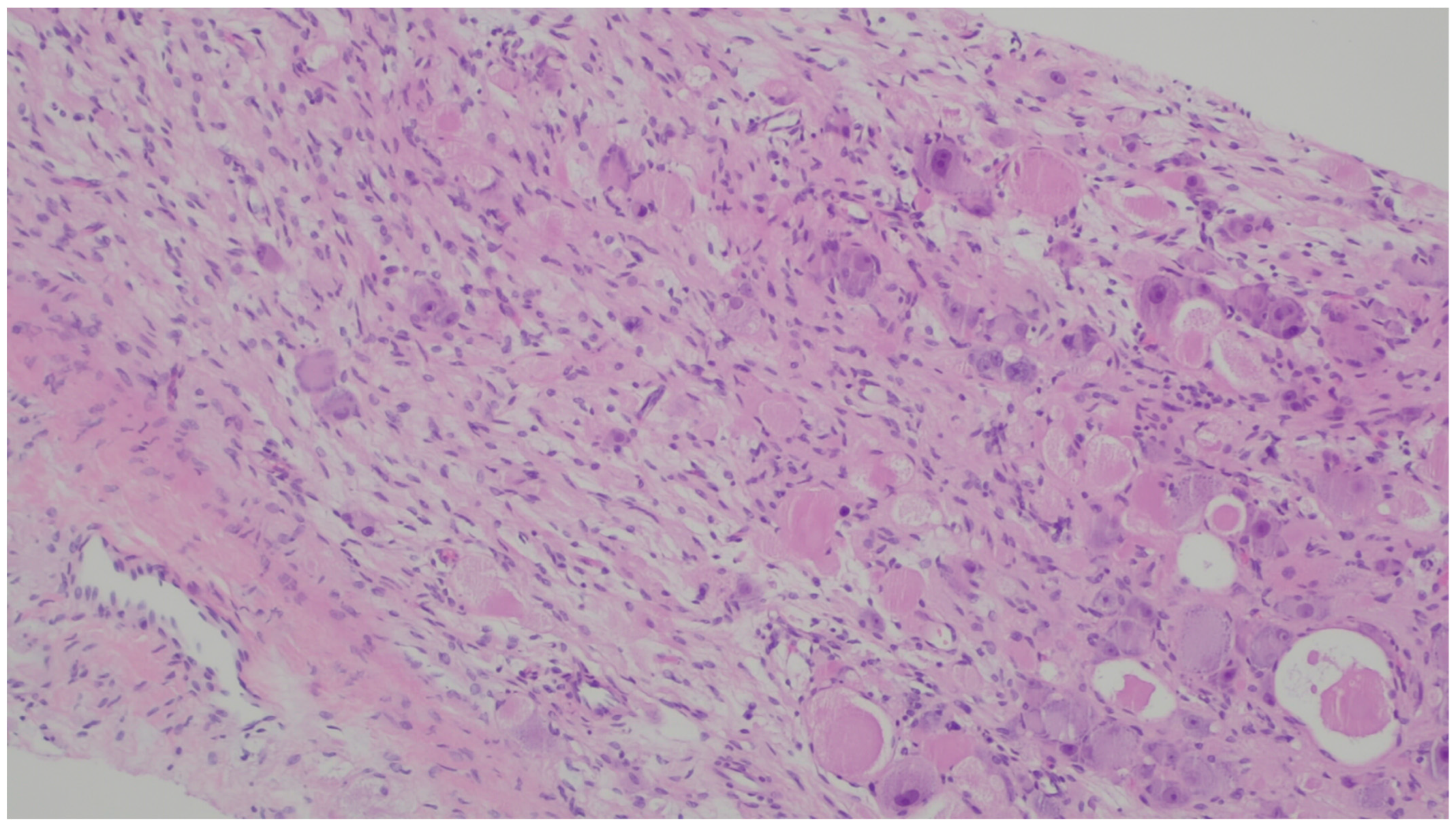 Gastrointestdisord 06 00019 g021 Gastrointestdisord 06 00019 g021