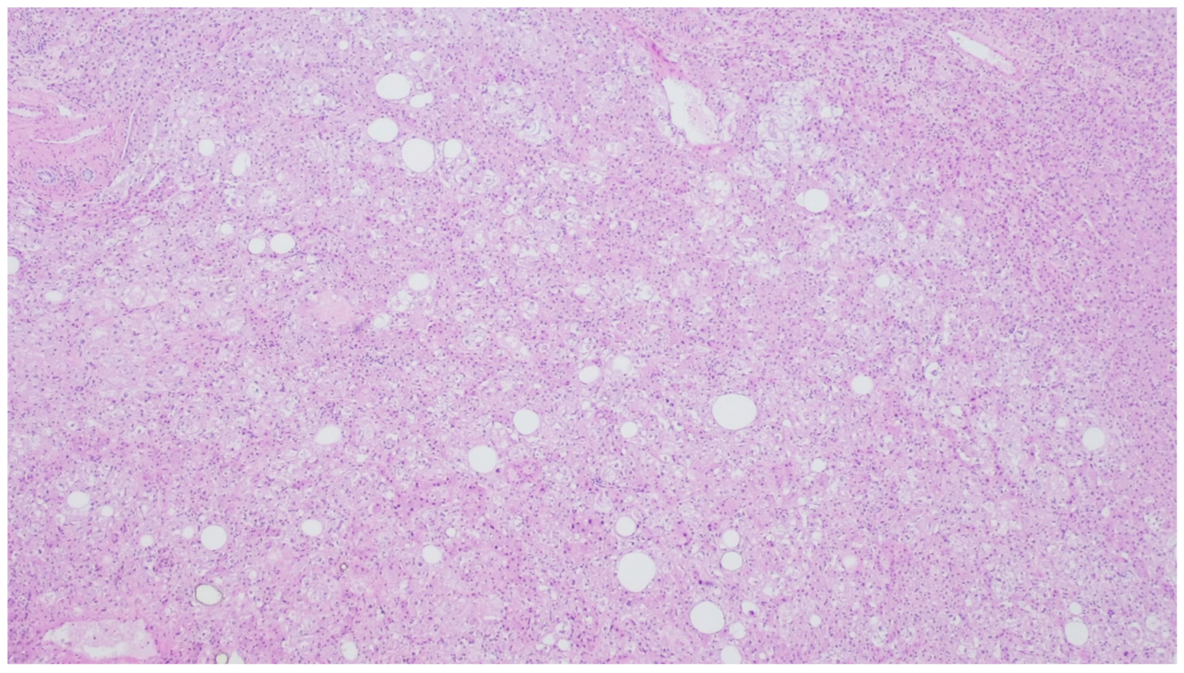 Gastrointestdisord 06 00019 g022 Gastrointestdisord 06 00019 g022