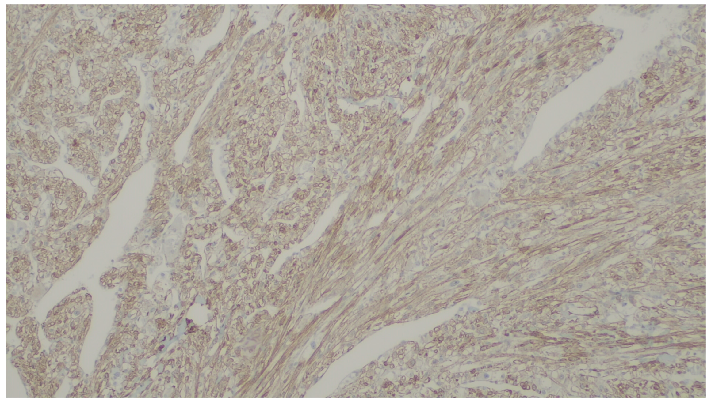 Gastrointestdisord 06 00019 g024 Gastrointestdisord 06 00019 g024