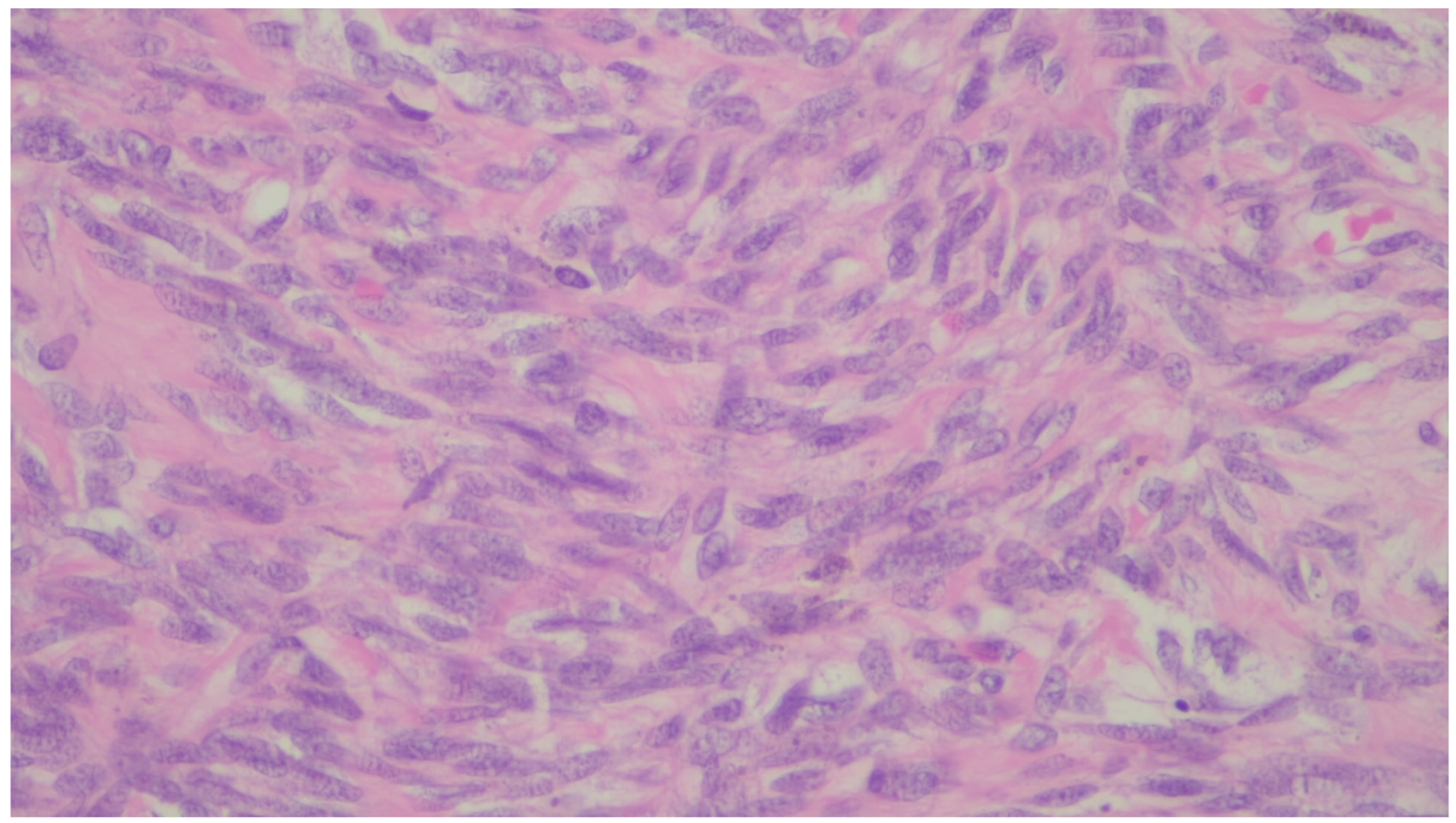 Gastrointestdisord 06 00019 g027 Gastrointestdisord 06 00019 g027