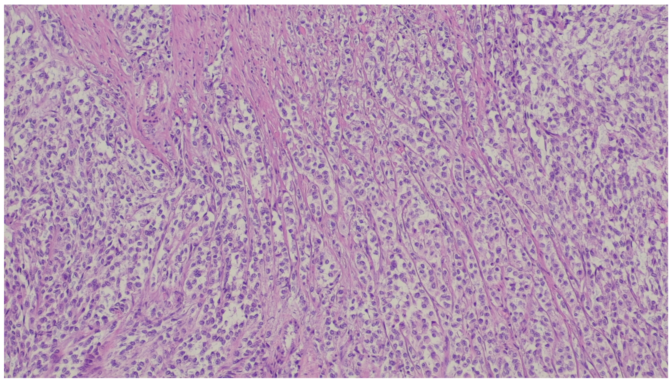 Gastrointestdisord 06 00019 g031 Gastrointestdisord 06 00019 g031