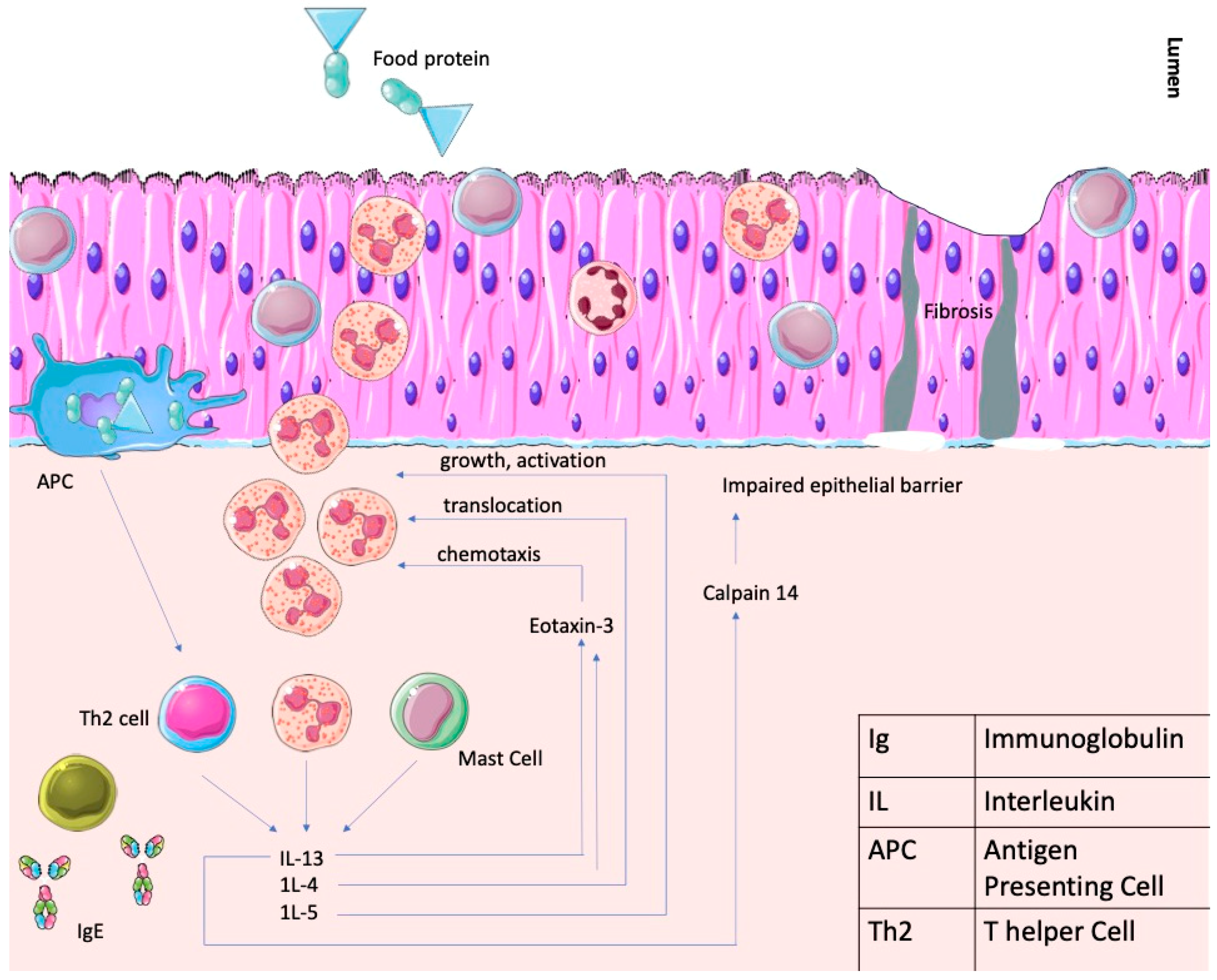 Gastrointestdisord 06 00033 g004