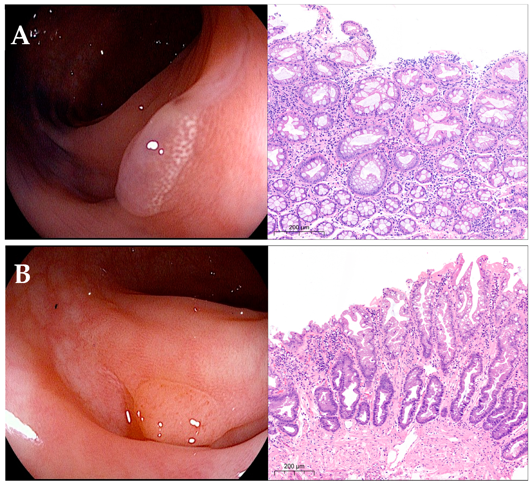 Gastrointestdisord 06 00044 g002