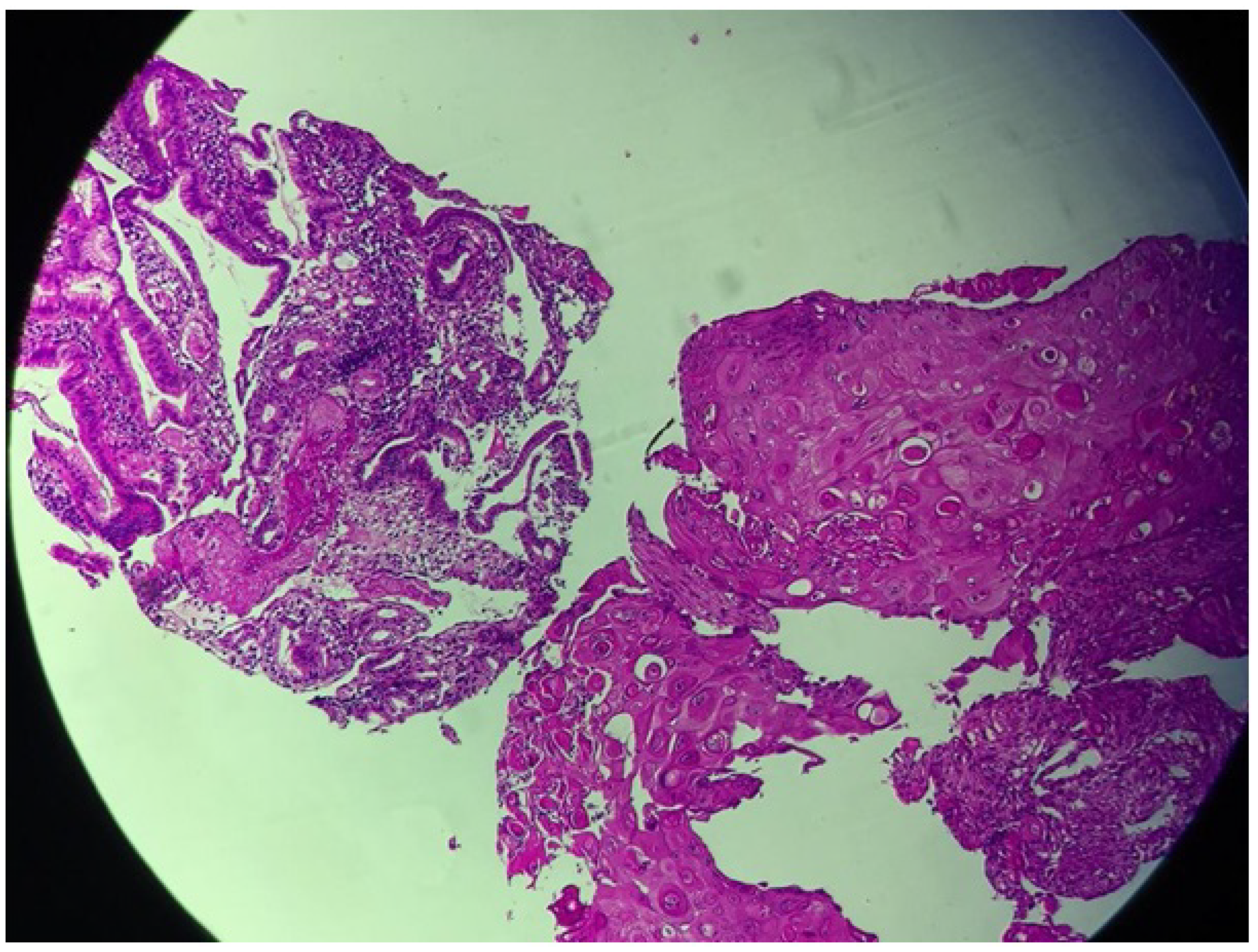 Gastrointestdisord 06 00055 g002