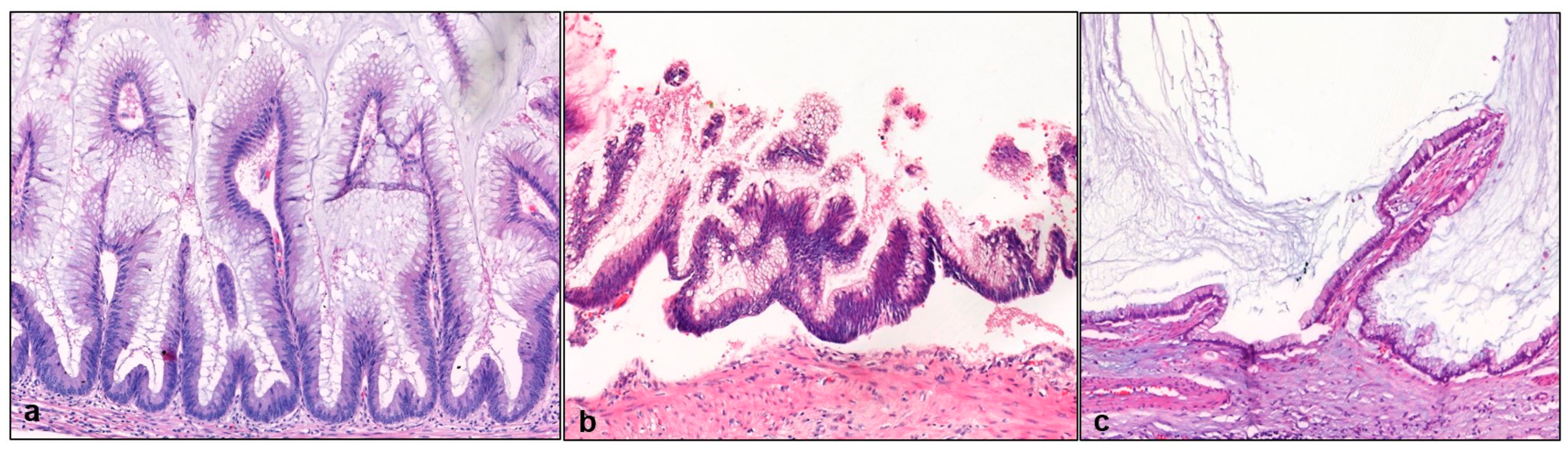 Gastrointestdisord 06 00064 g001