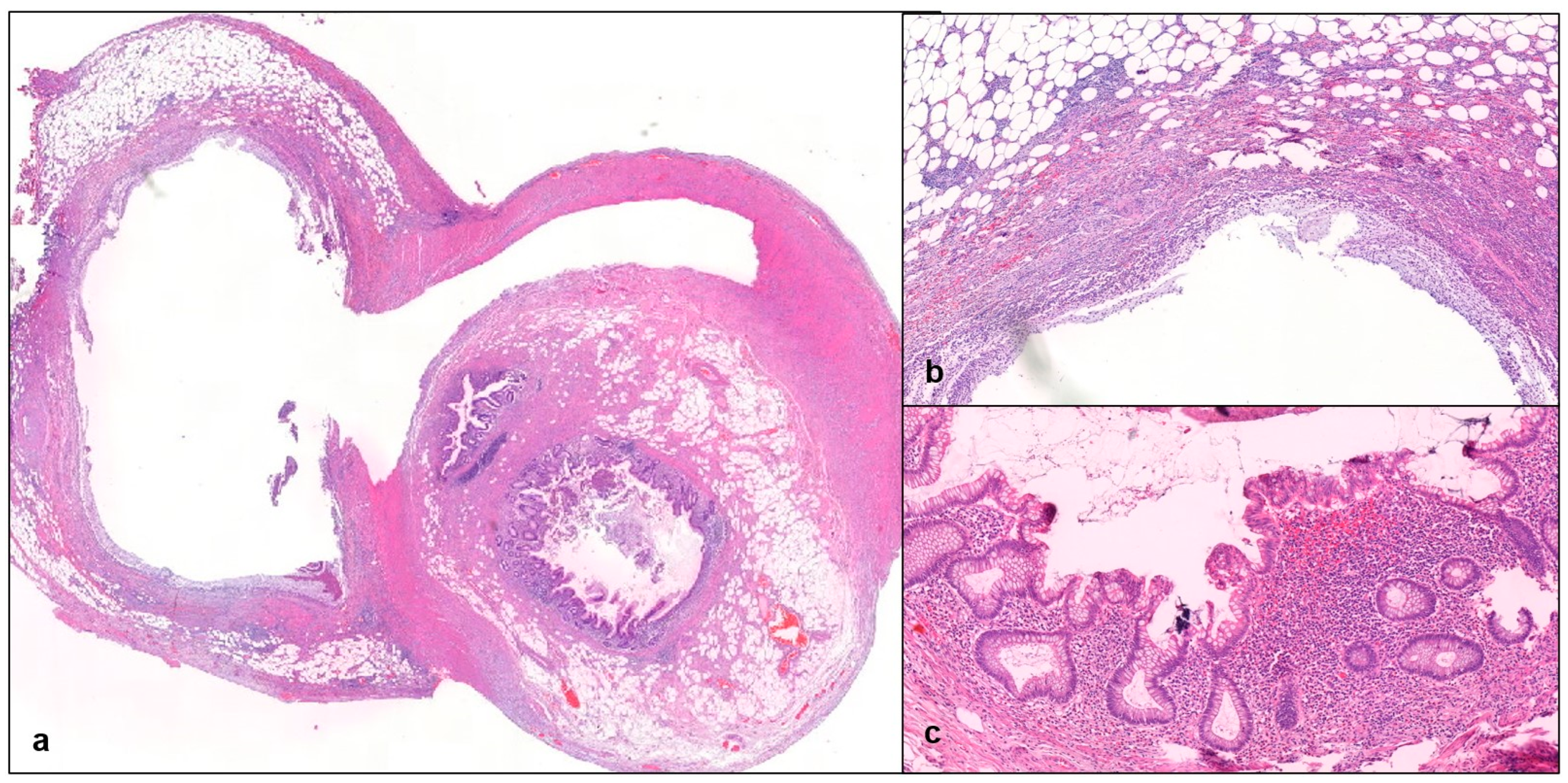 Gastrointestdisord 06 00064 g002
