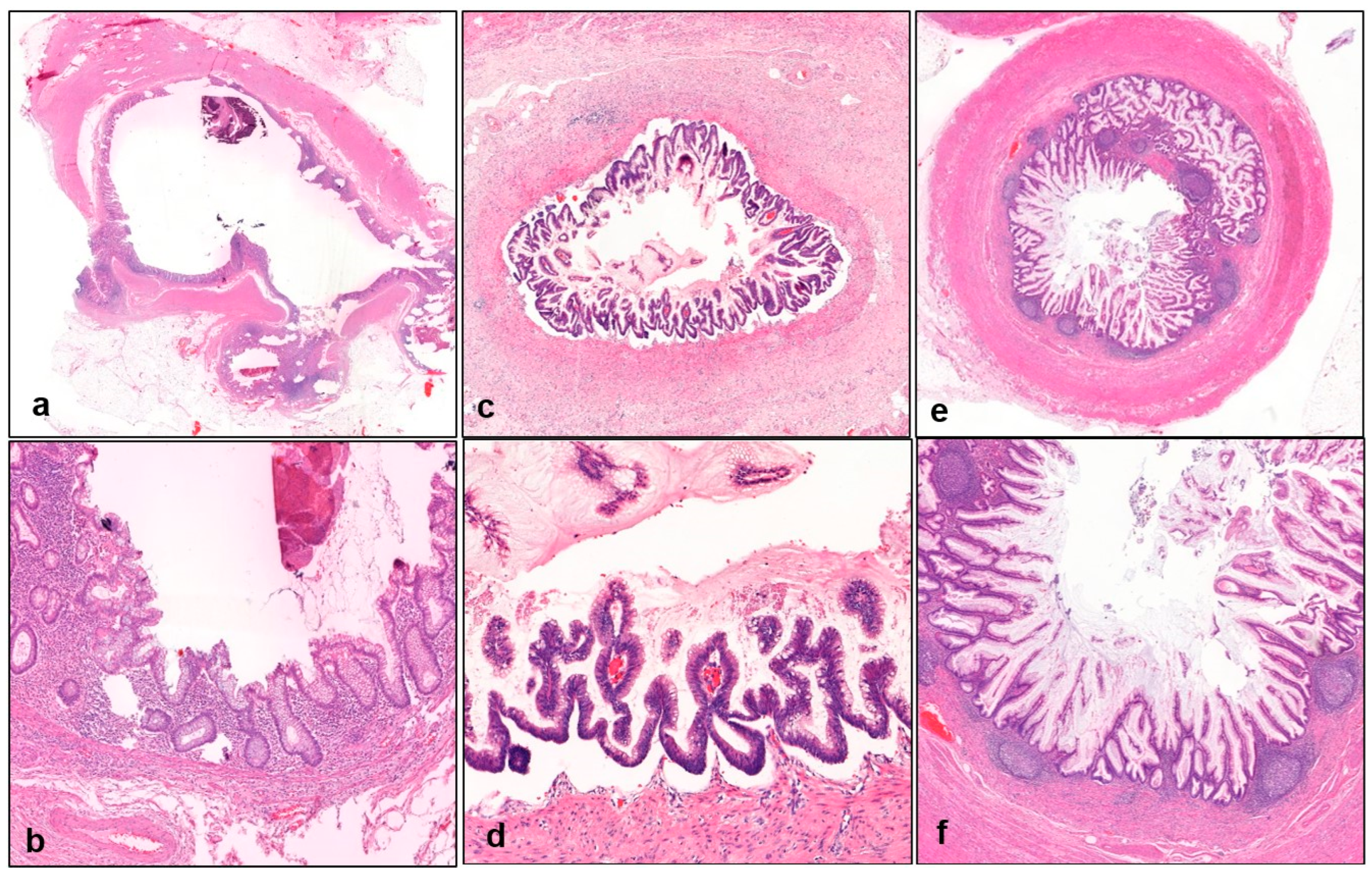 Gastrointestdisord 06 00064 g003