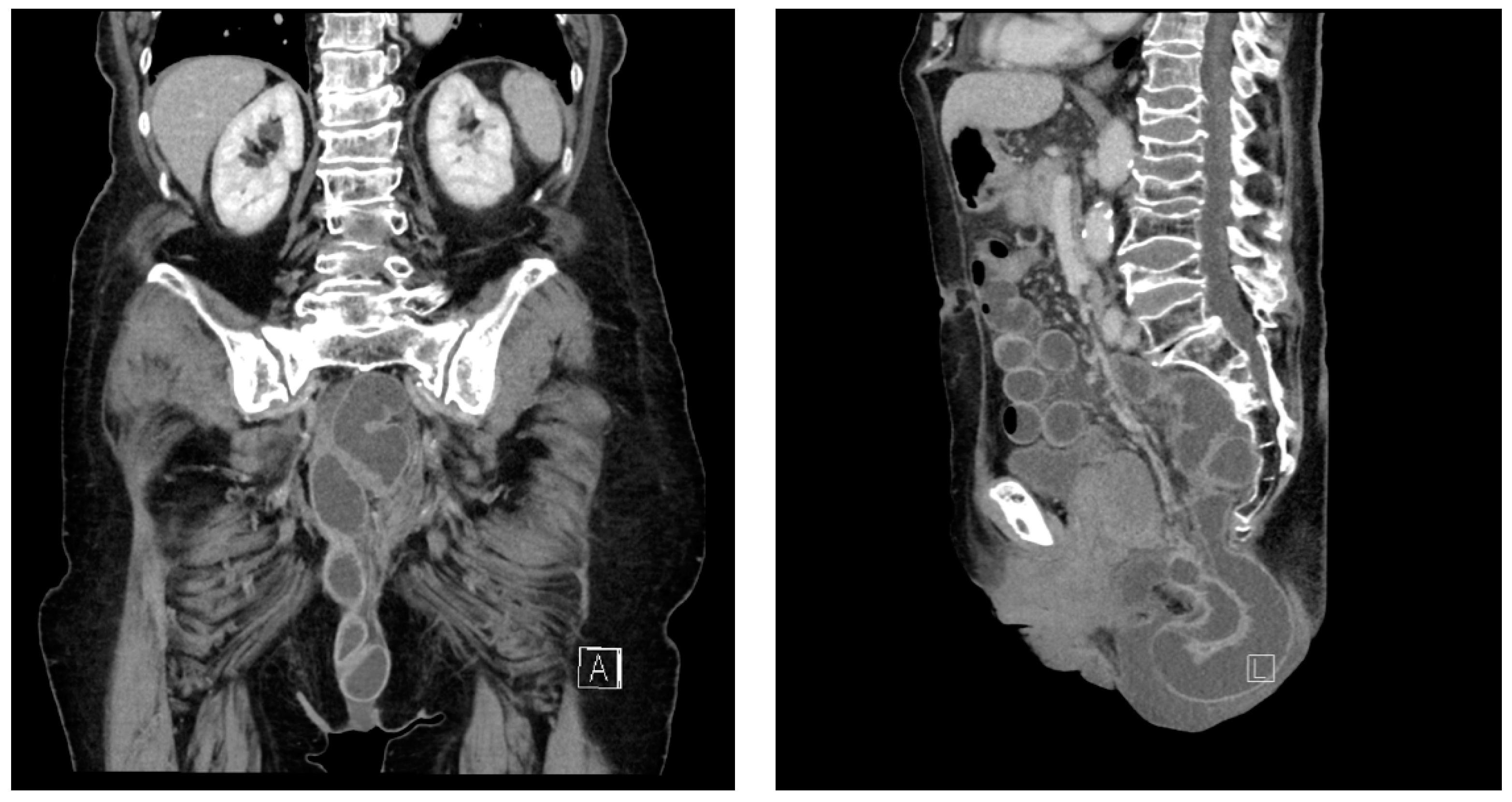 Gastrointestdisord 06 00068 g001