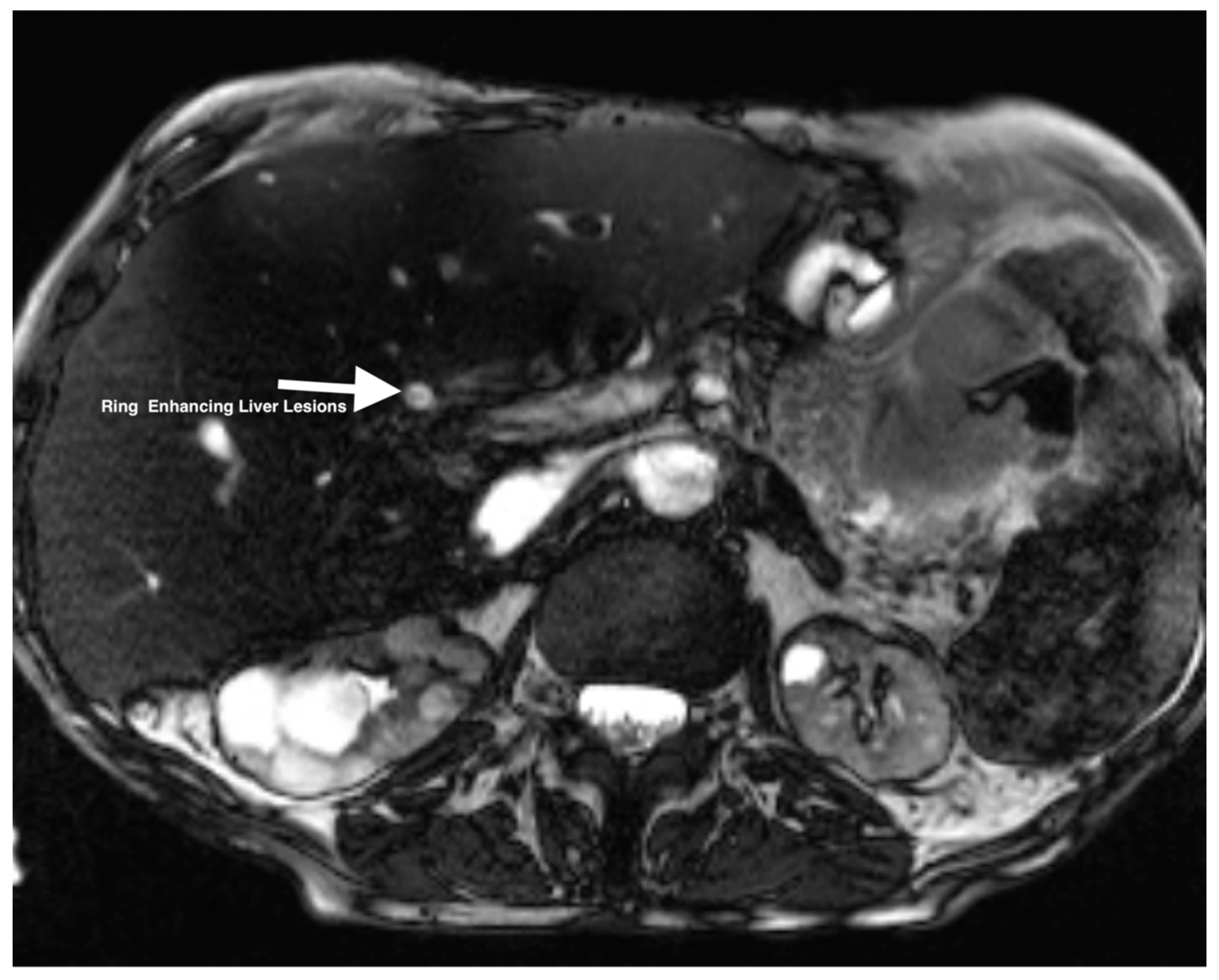 Gastrointestdisord 07 00002 g001 Gastrointestdisord 07 00002 g001