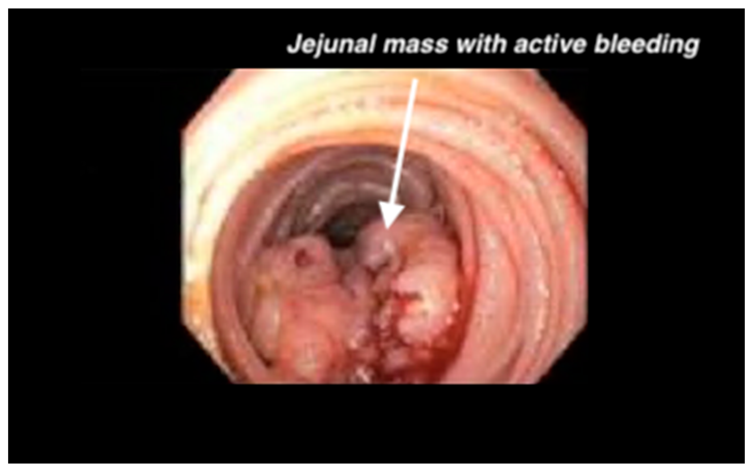 Gastrointestdisord 07 00002 g004 Gastrointestdisord 07 00002 g004