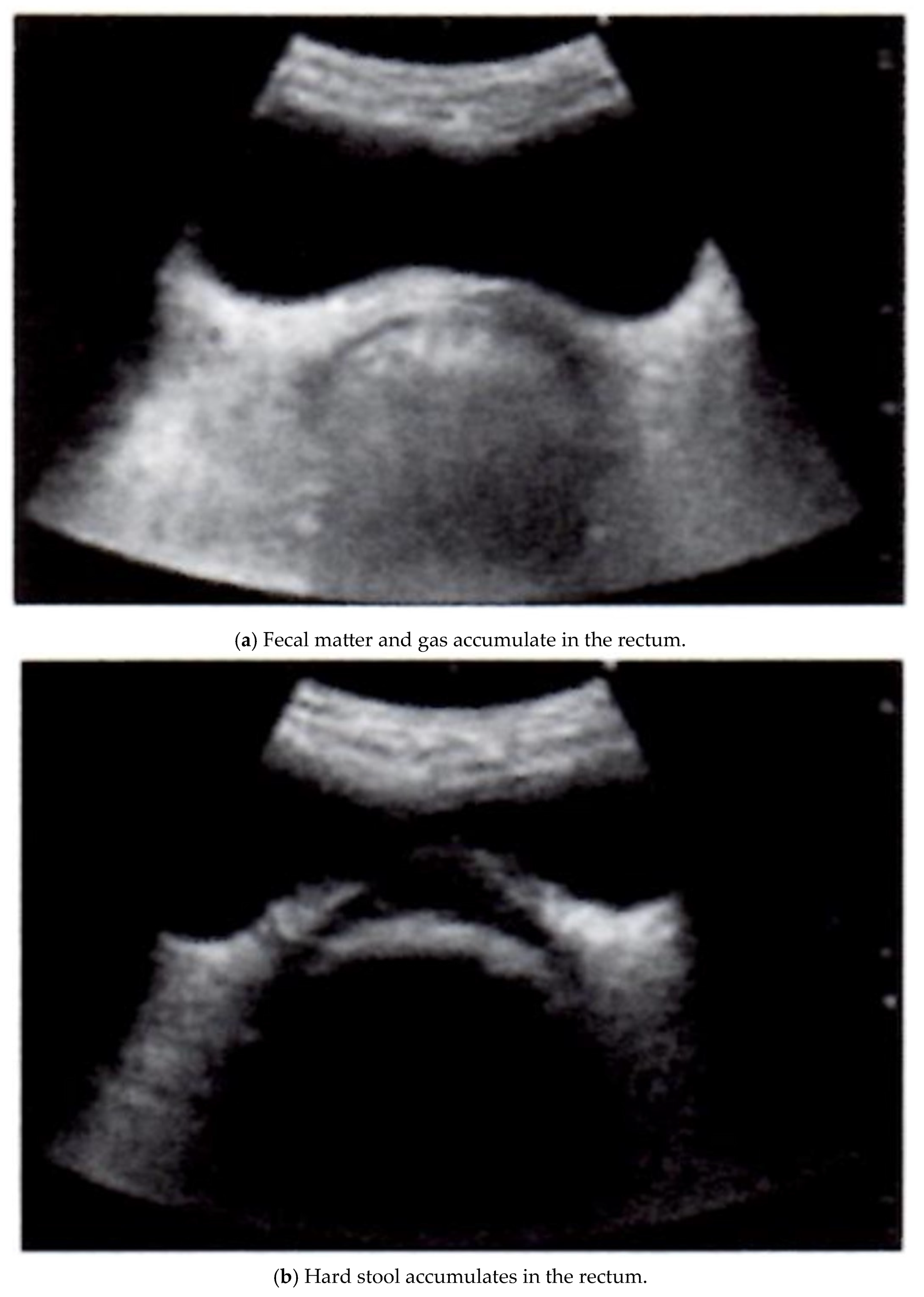 Gastrointestdisord 07 00012 g001a Gastrointestdisord 07 00012 g001a