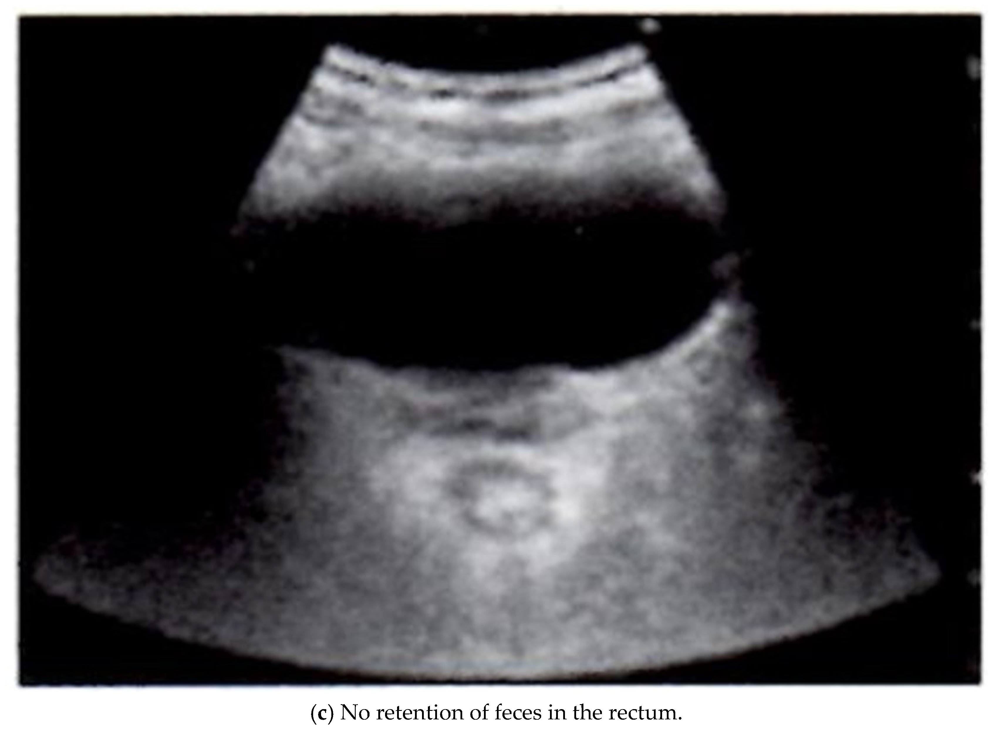 Gastrointestdisord 07 00012 g001b Gastrointestdisord 07 00012 g001b