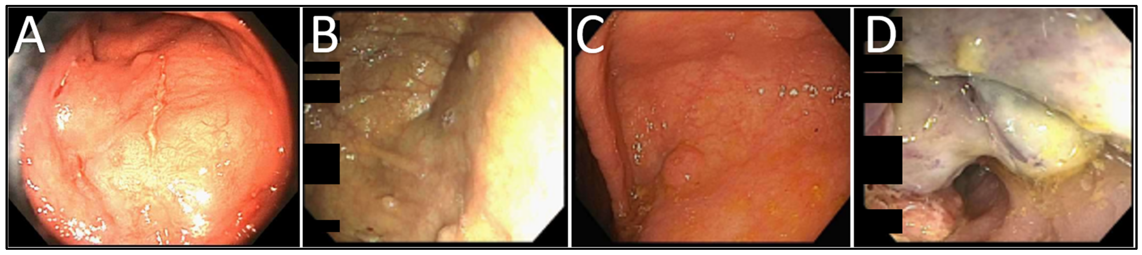 Gastrointestdisord 07 00014 g002