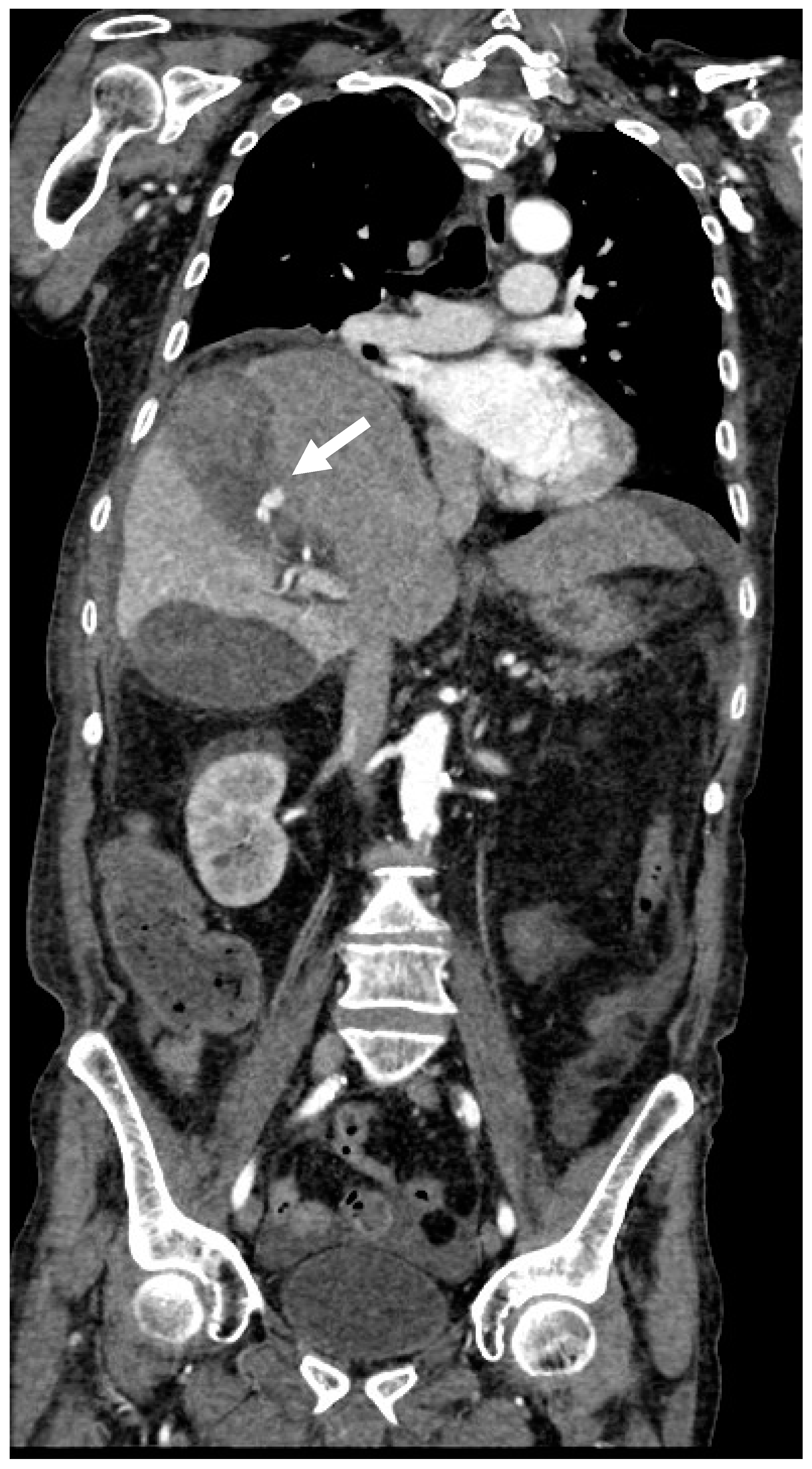 Gastrointestdisord 07 00020 g006